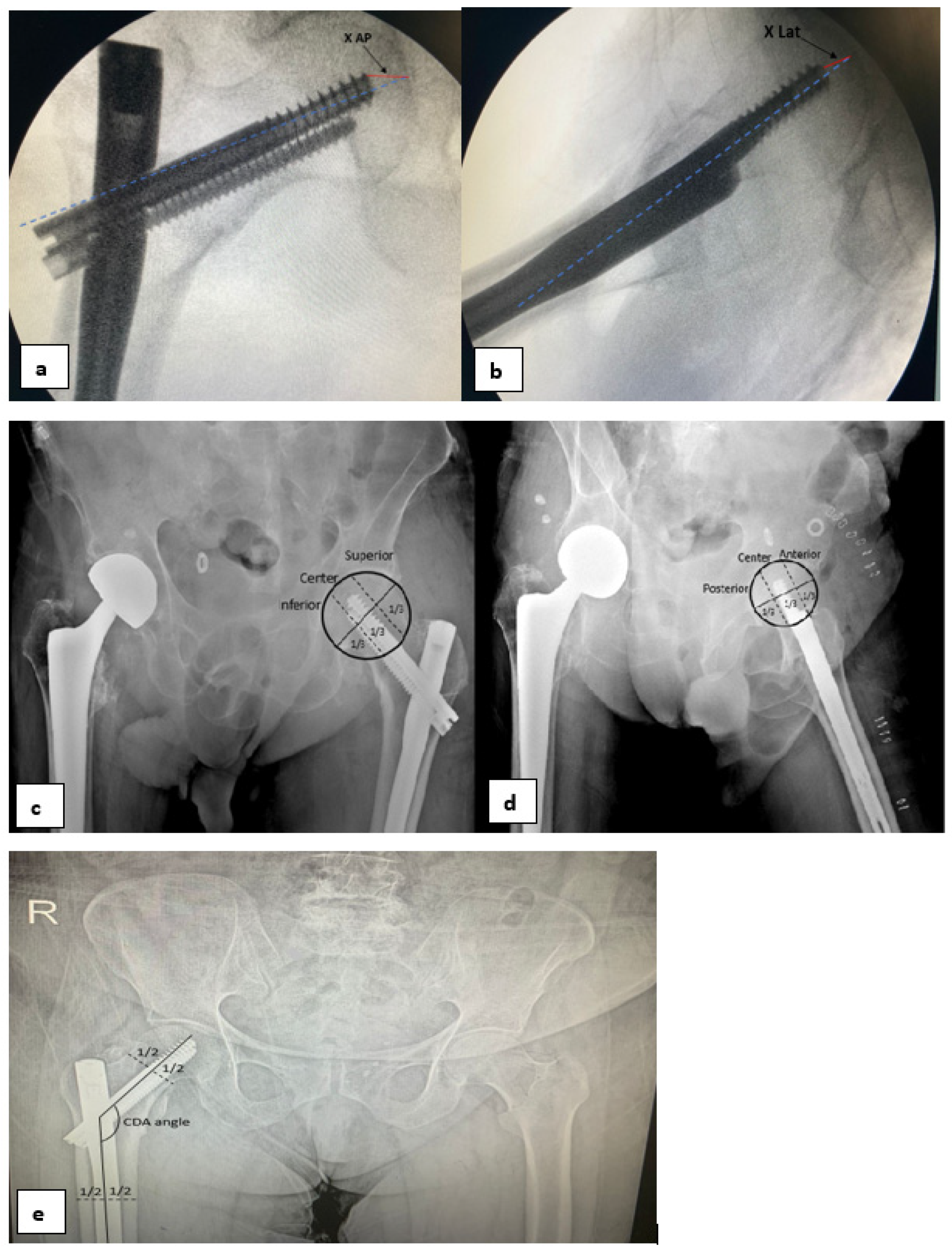 Medicina 60 00646 g002