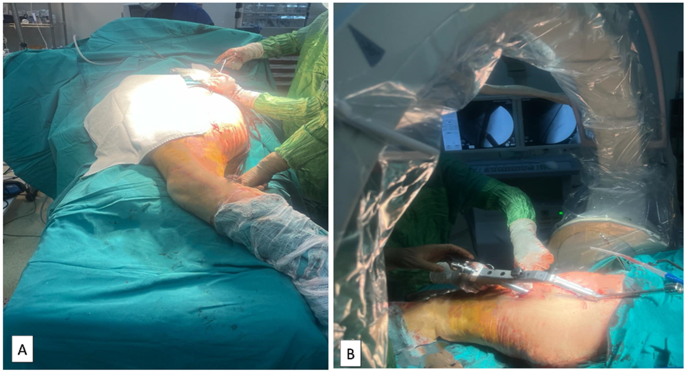 Medicina 60 00646 g006