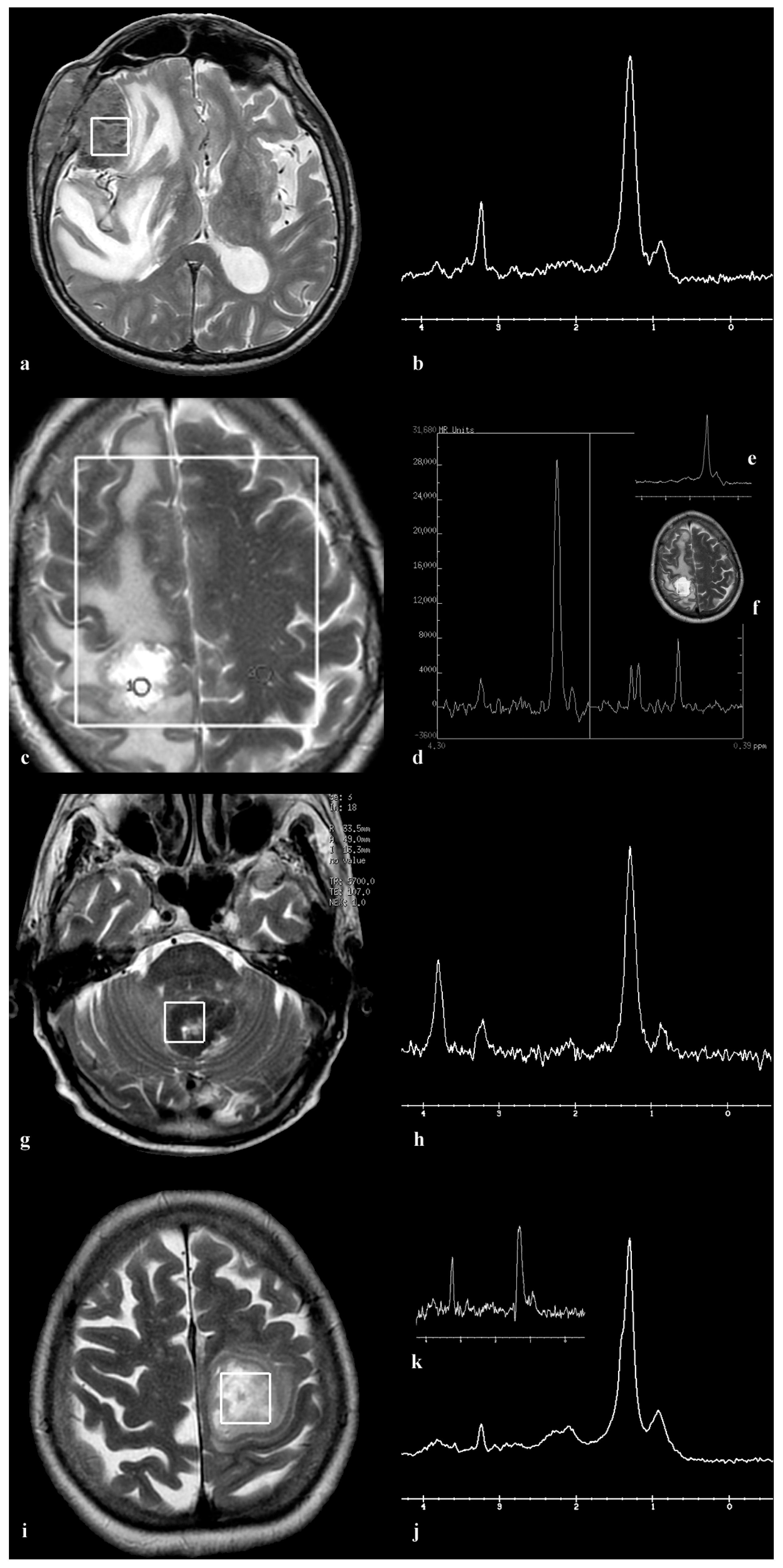 Medicina 60 00662 g001