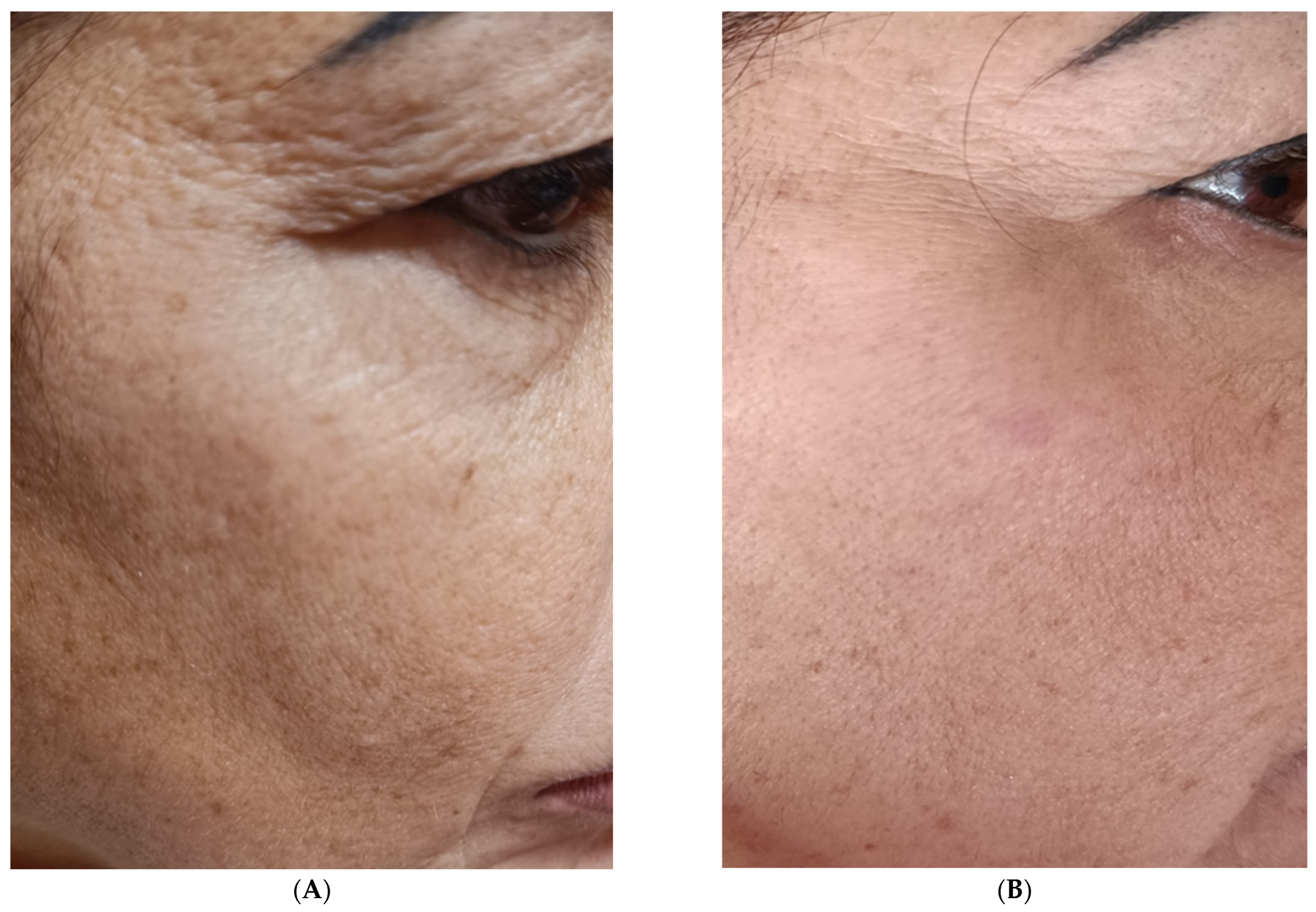 Medicina 60 00670 g005