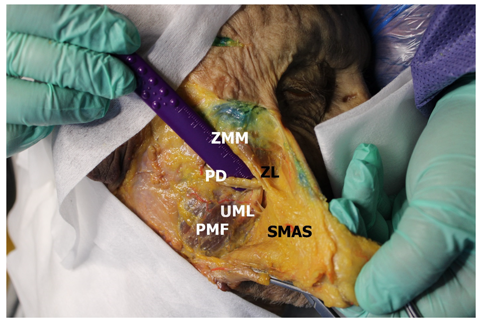 Medicina 60 00681 g002