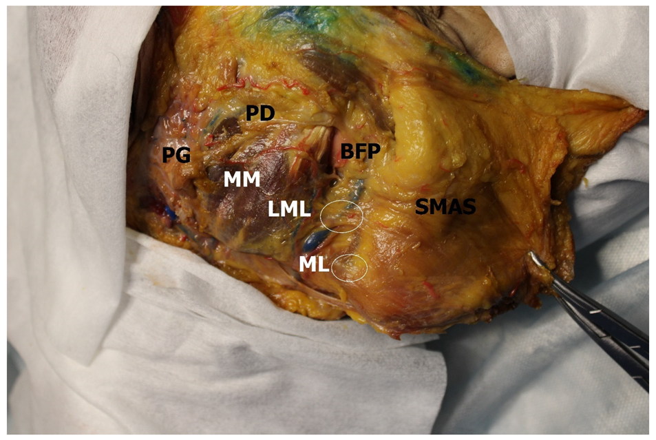 Medicina 60 00681 g003