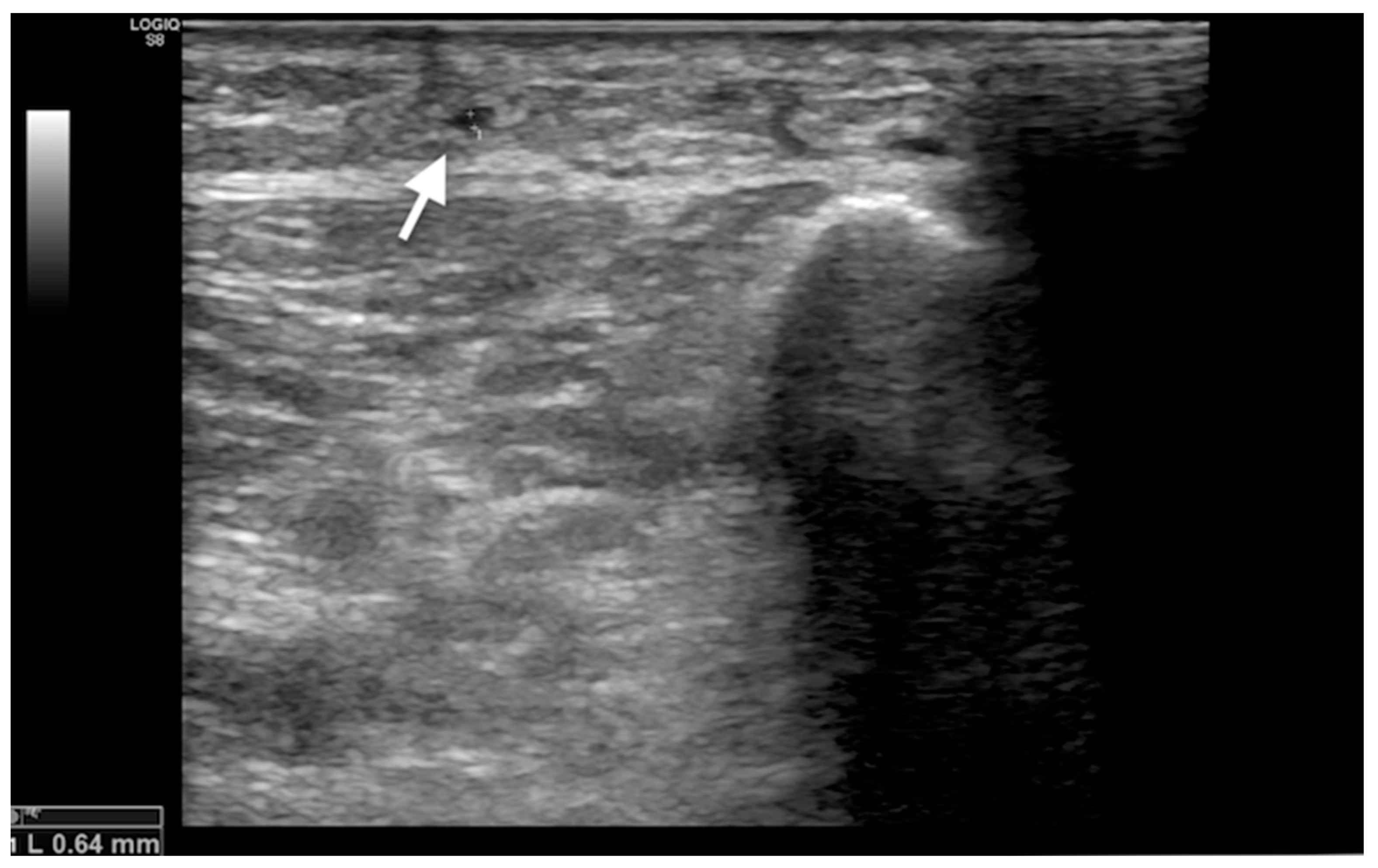 Medicina 60 00682 g004