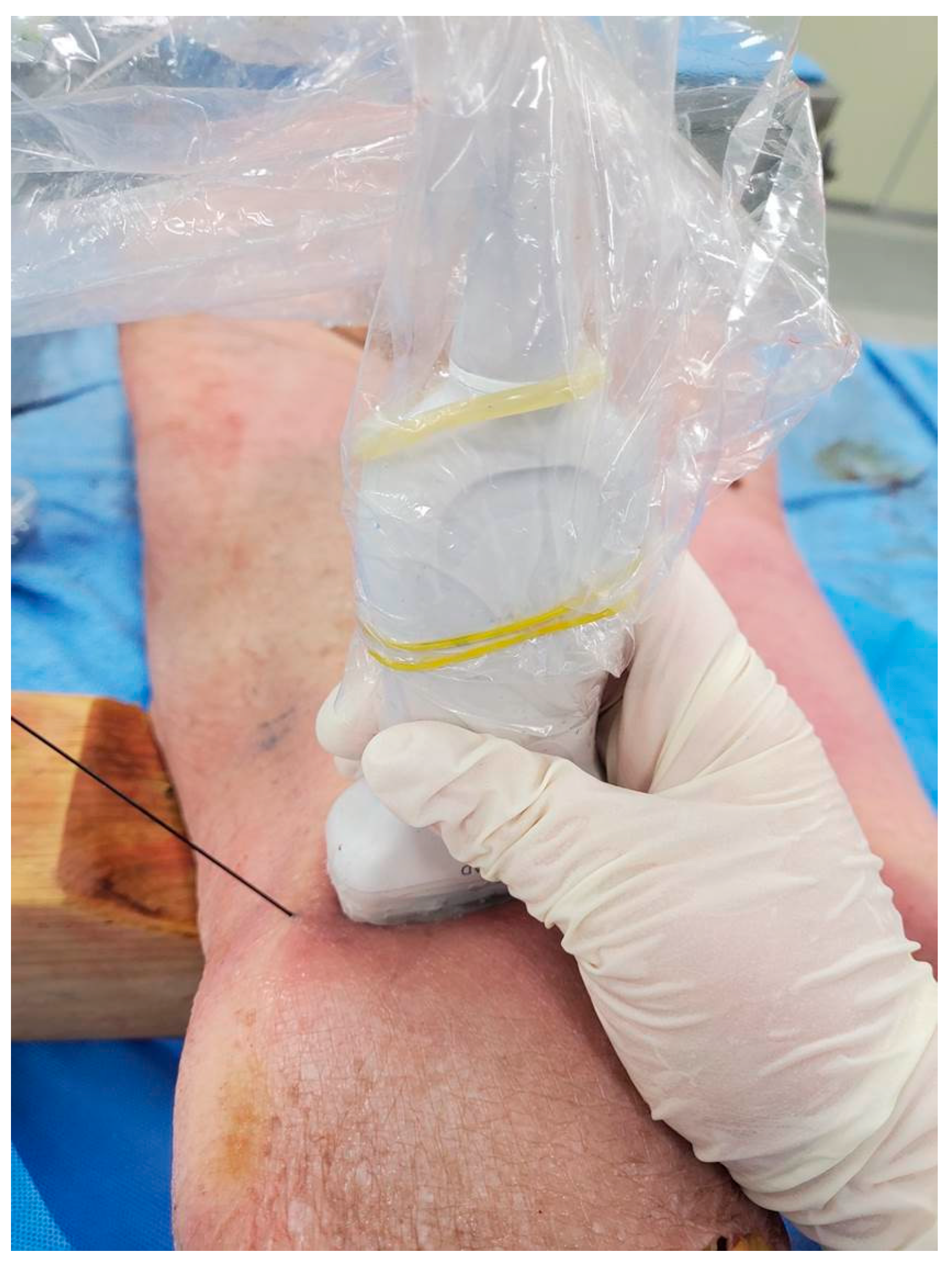 Medicina 60 00689 g001