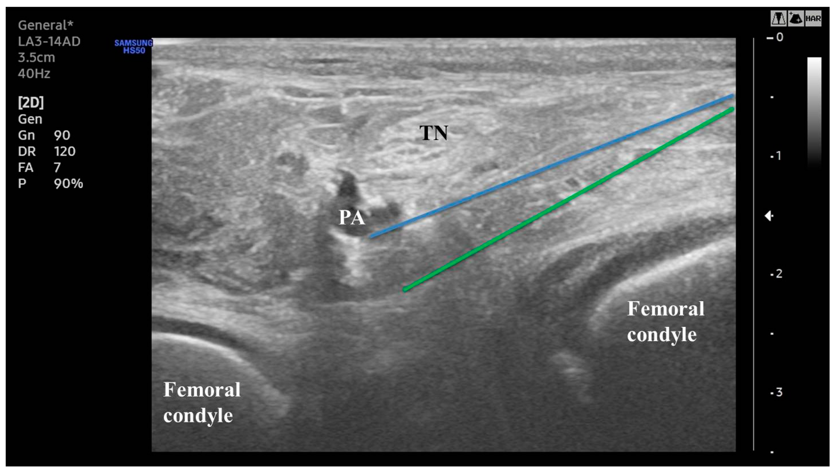 Medicina 60 00689 g002