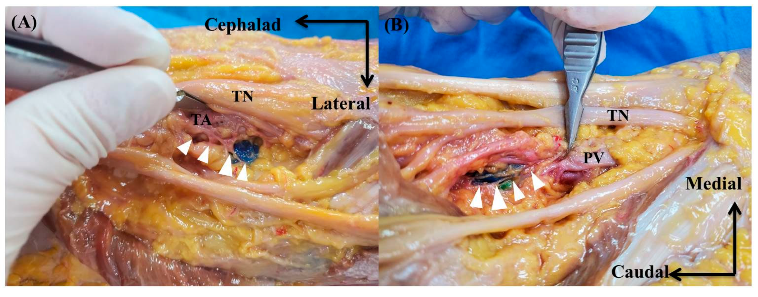 Medicina 60 00689 g003