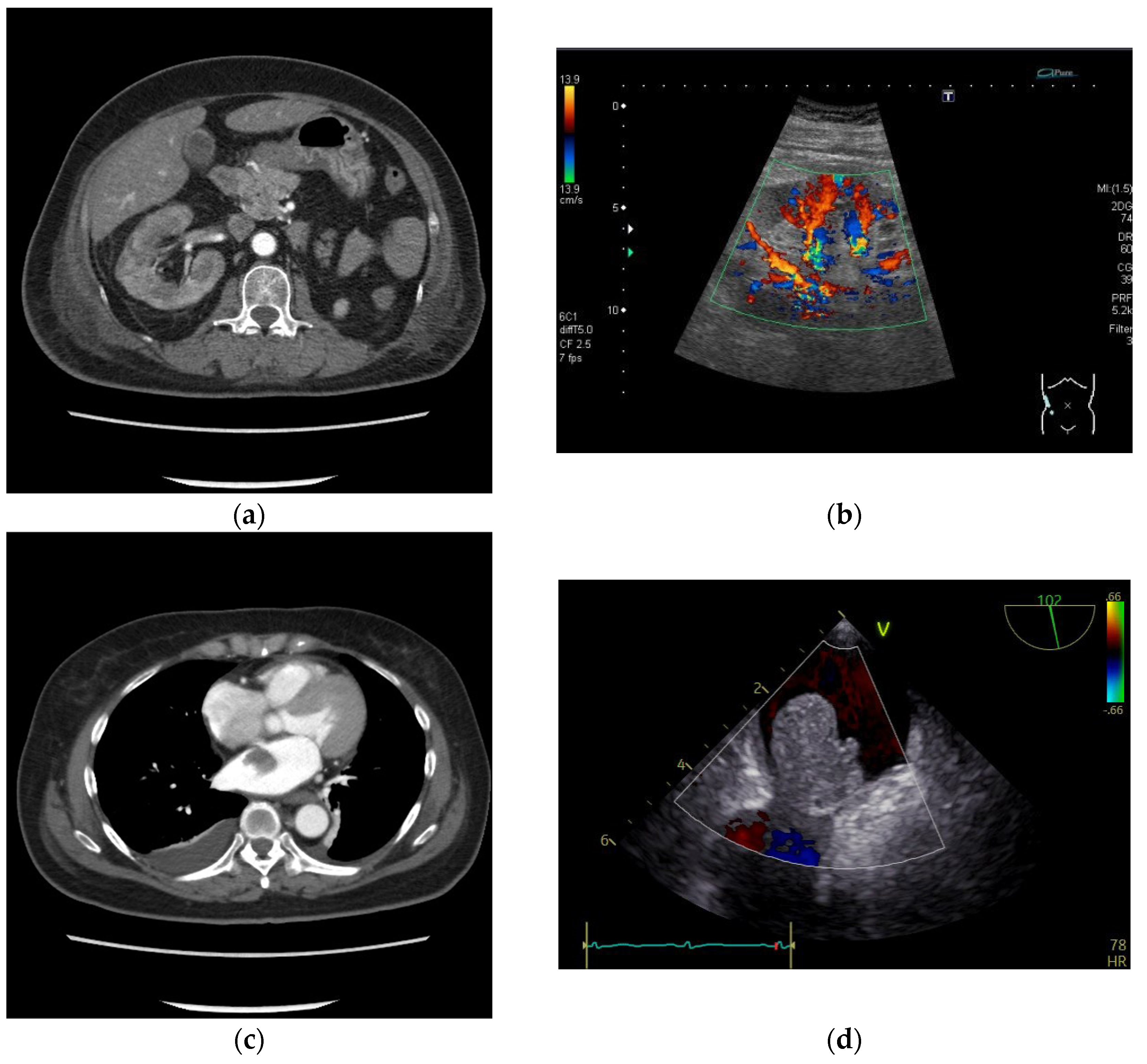 Medicina 60 00694 g002
