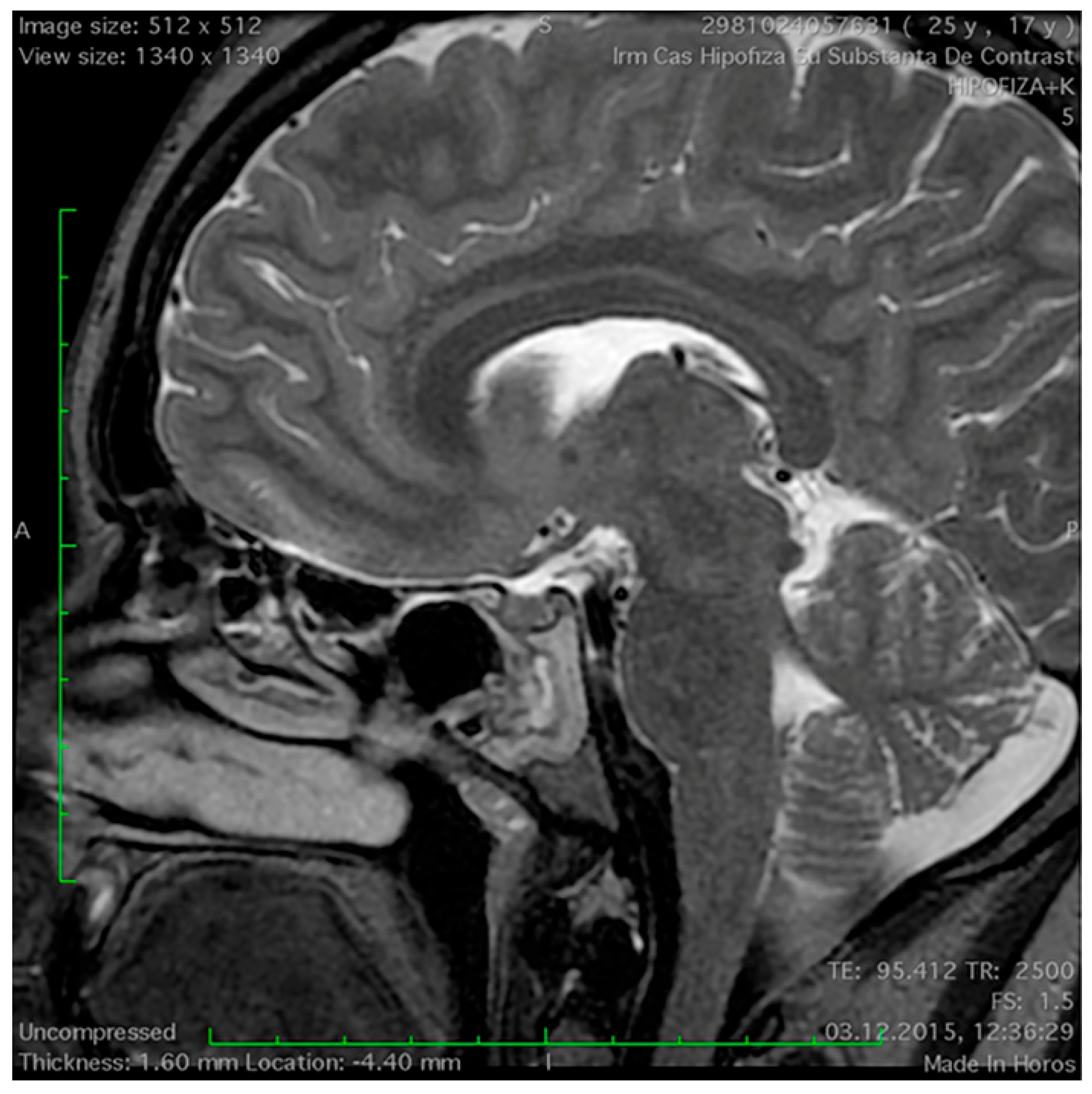 Medicina 60 00708 g001 Medicina 60 00708 g001