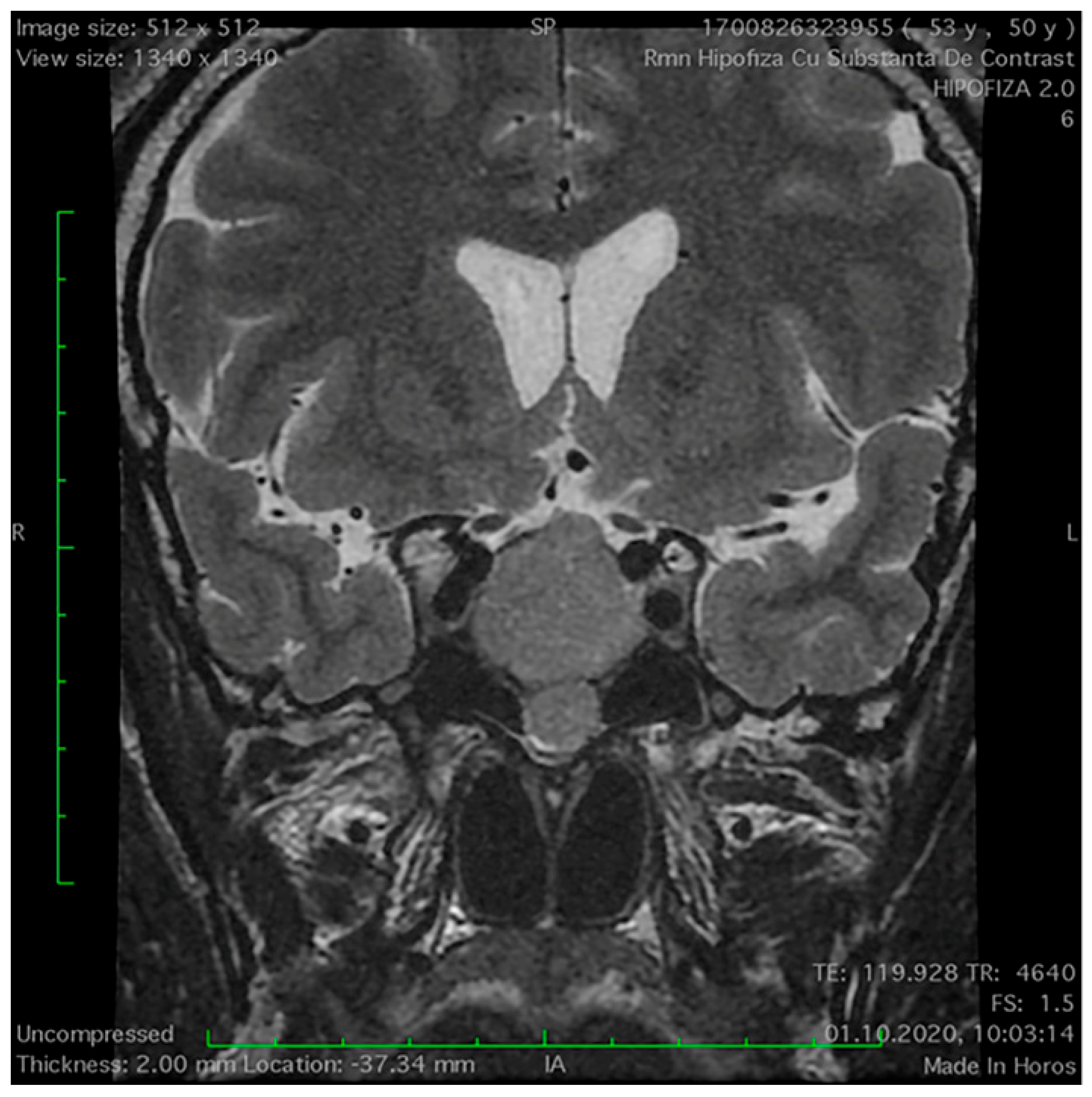 Medicina 60 00708 g003 Medicina 60 00708 g003