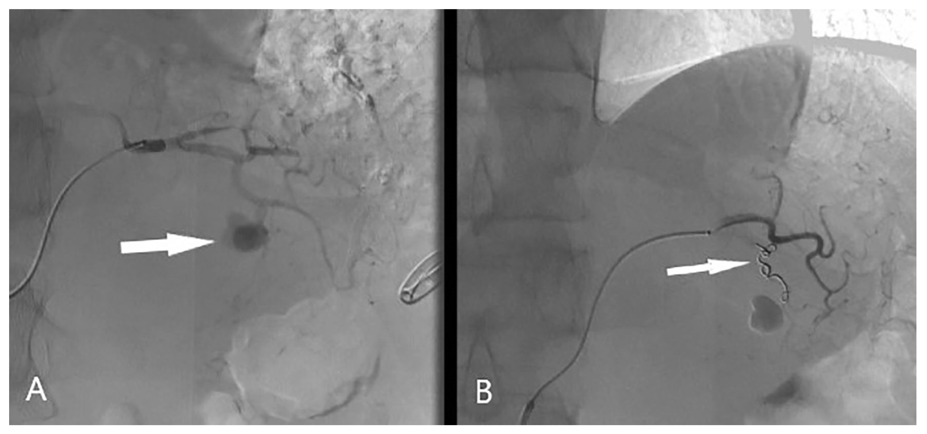Medicina 60 00714 g002
