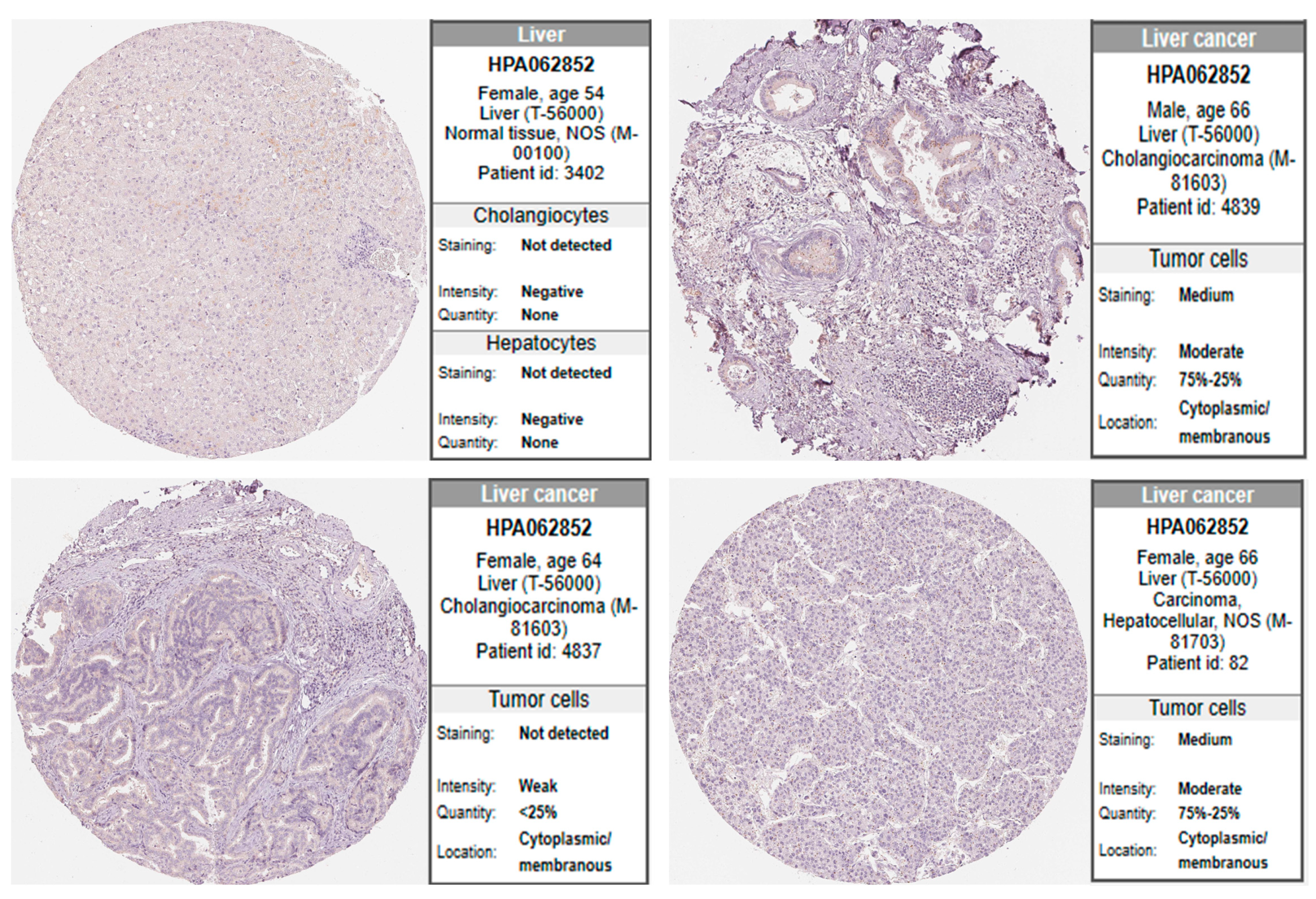 Medicina 60 00716 g005 Medicina 60 00716 g005