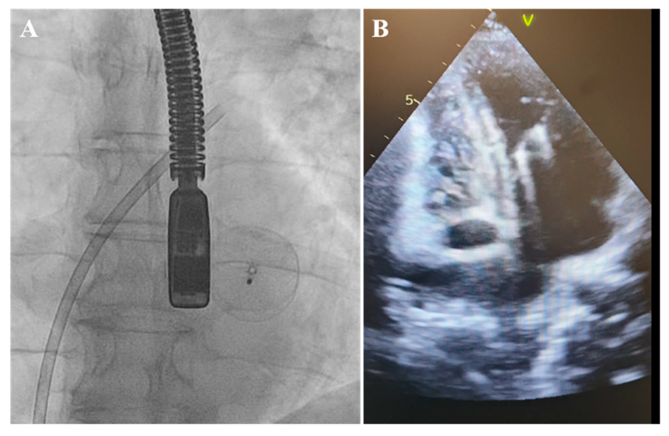 Medicina 60 00717 g003