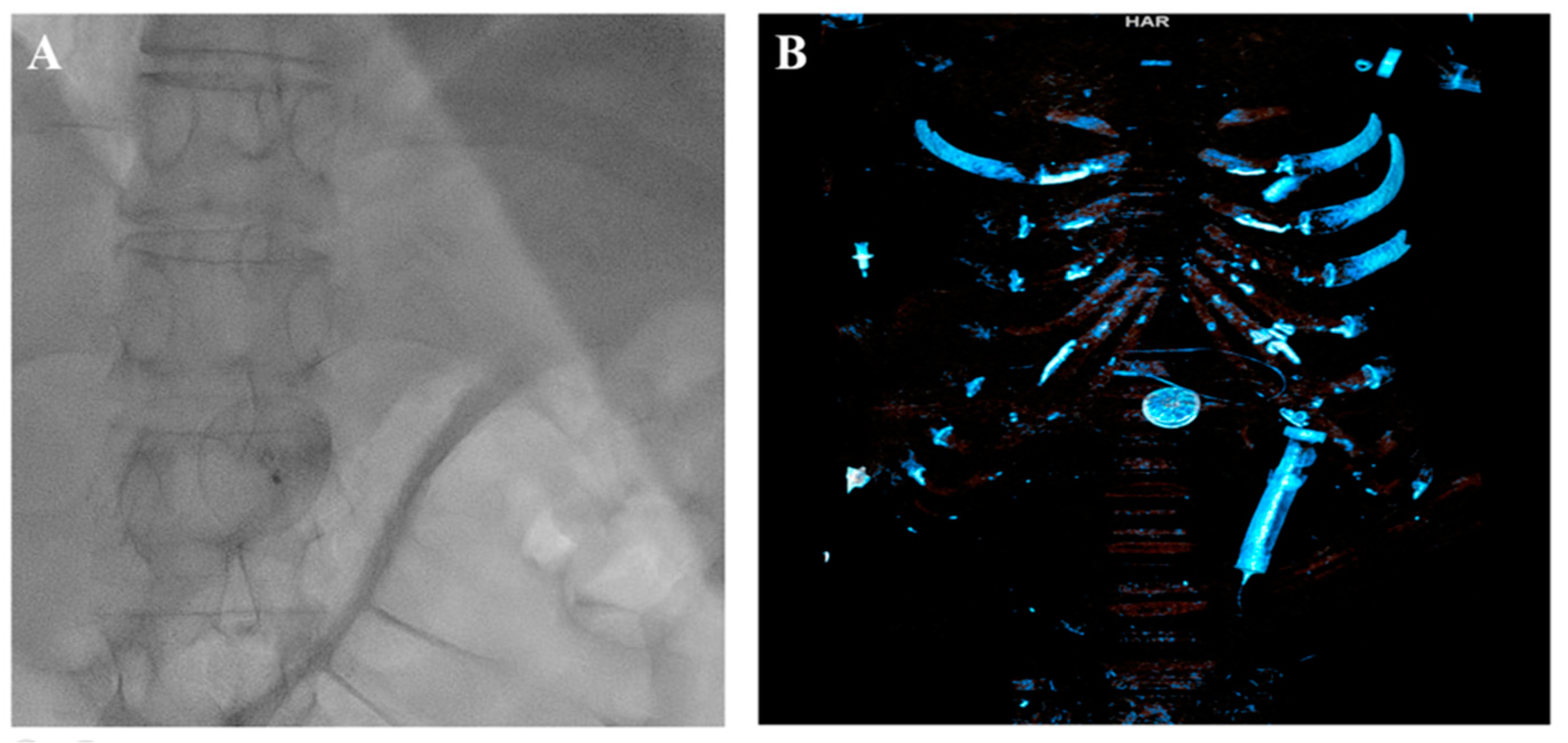 Medicina 60 00717 g004