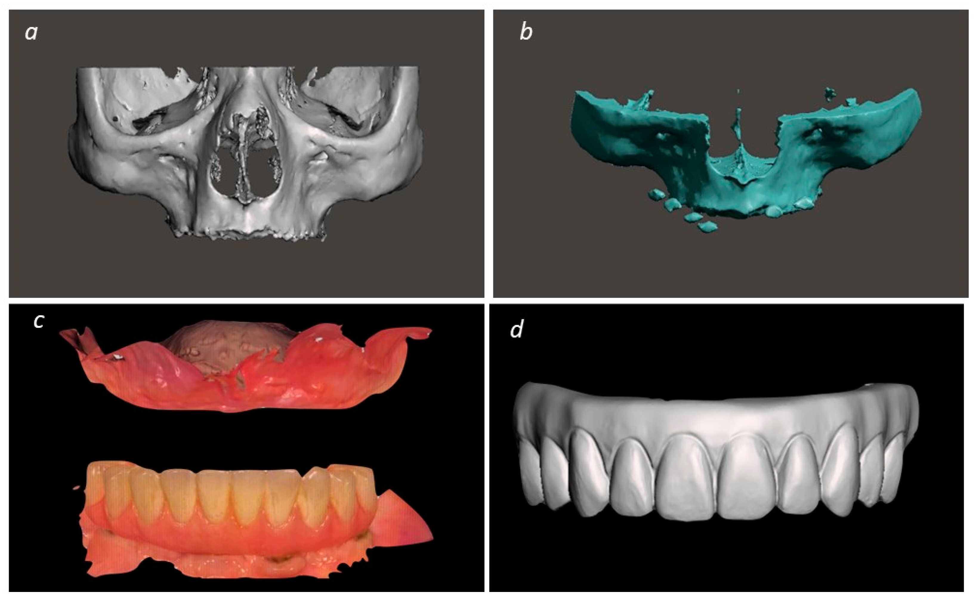 Medicina 60 00720 g002a