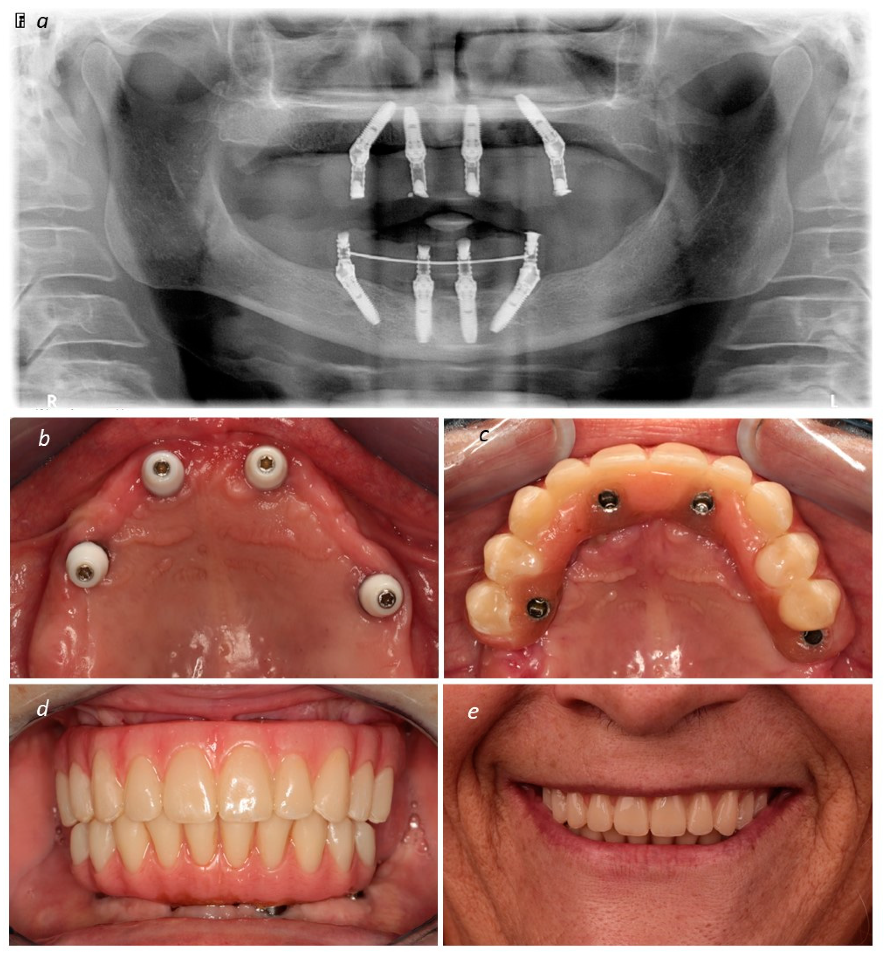 Medicina 60 00720 g004
