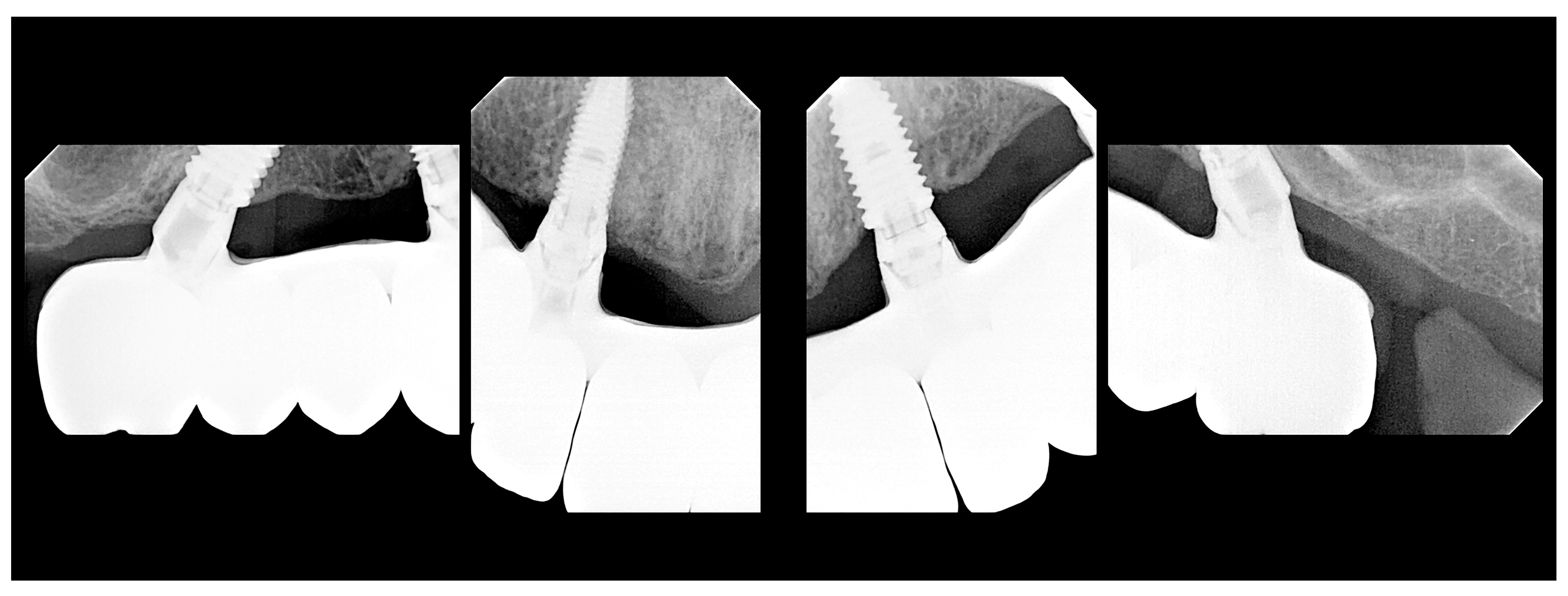 Medicina 60 00720 g005