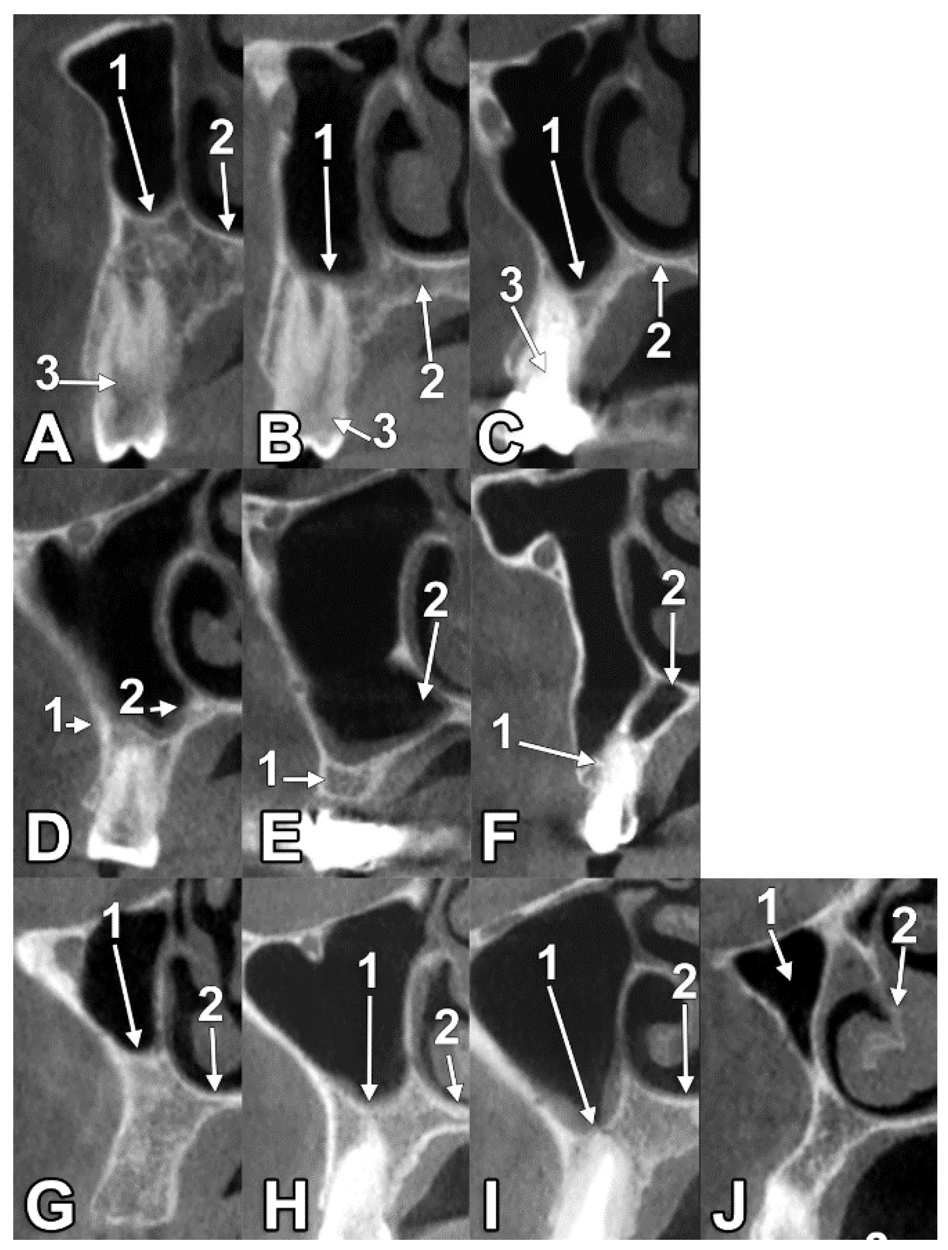Medicina 60 00726 g002 Medicina 60 00726 g002