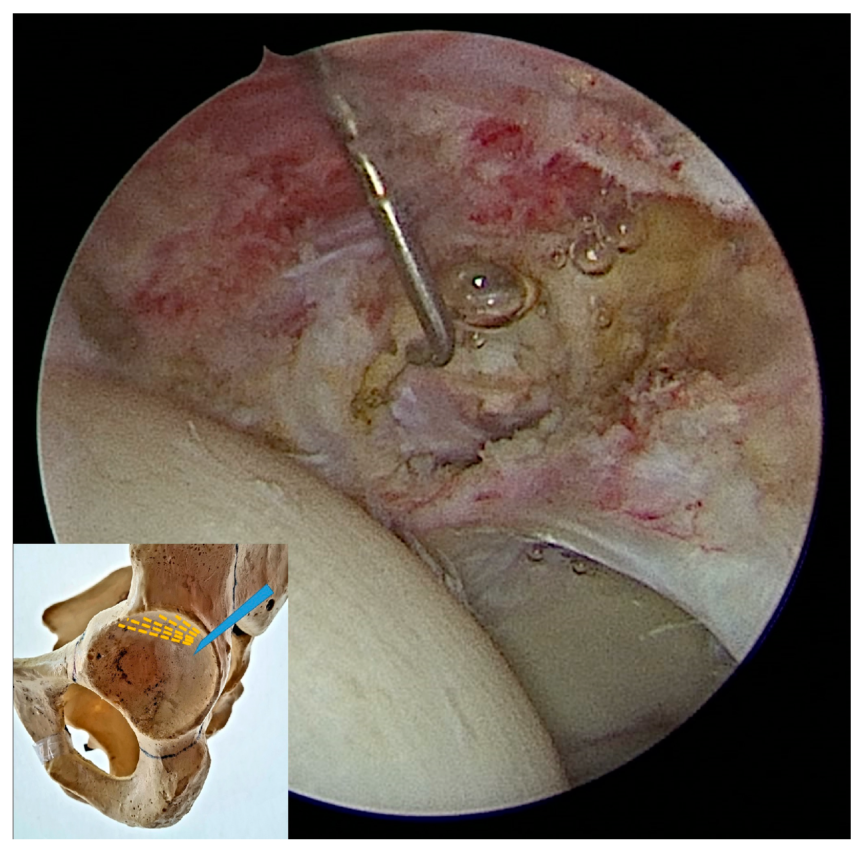 Medicina 60 00738 g002