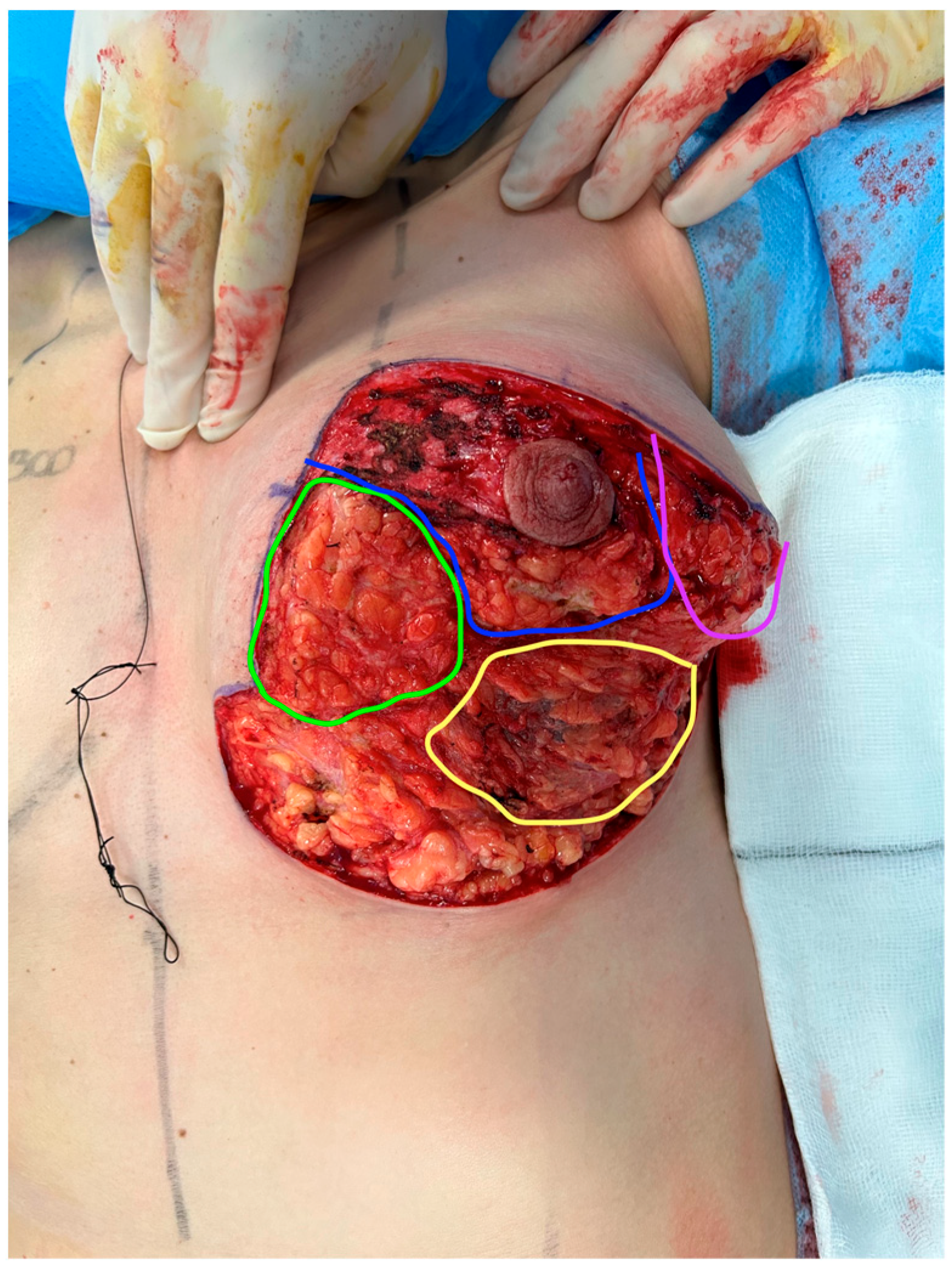 Medicina 60 00743 g001