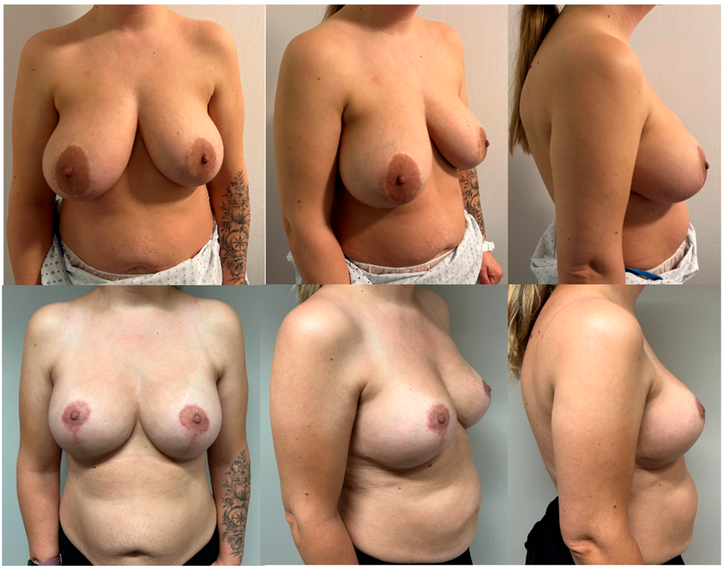 Medicina 60 00743 g003