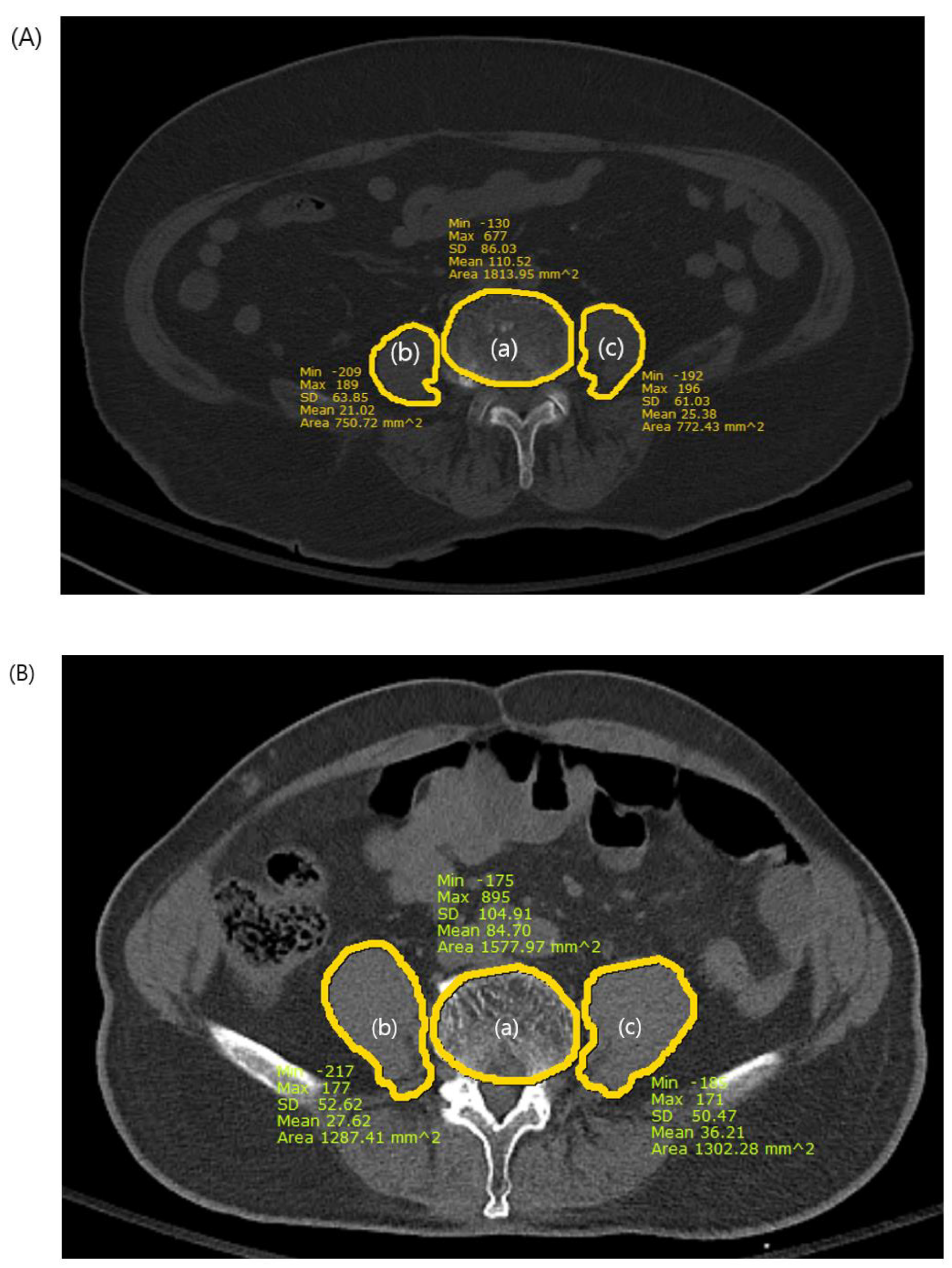 Medicina 60 00745 g002