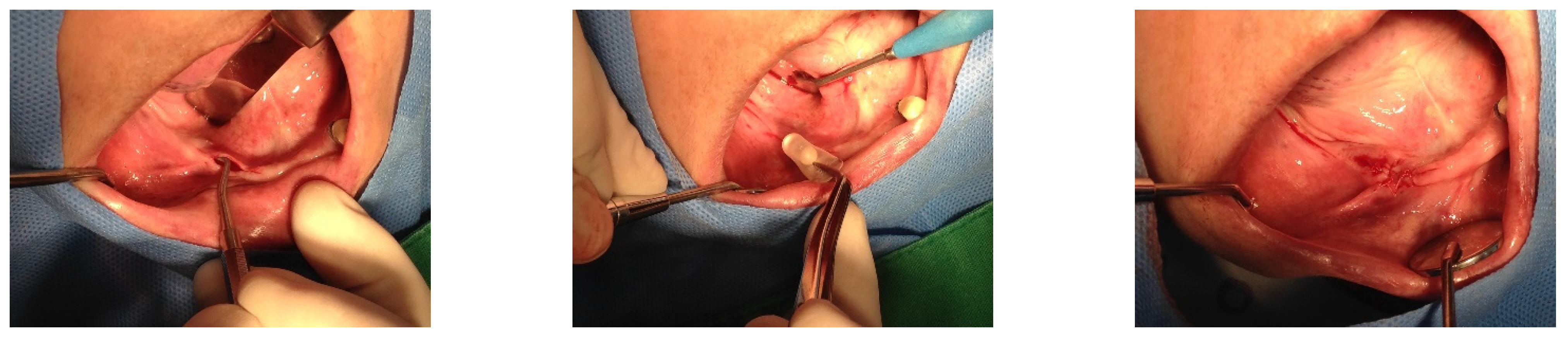 Medicina 60 00759 g002