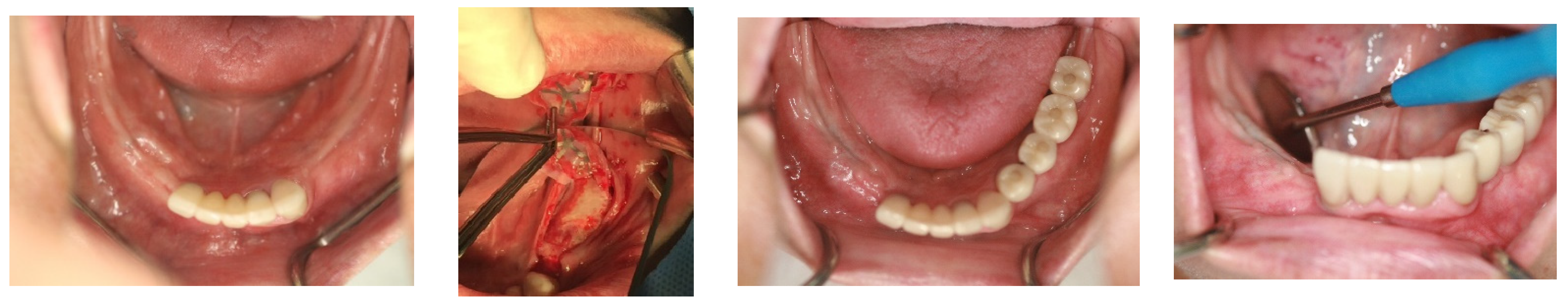 Medicina 60 00759 g005