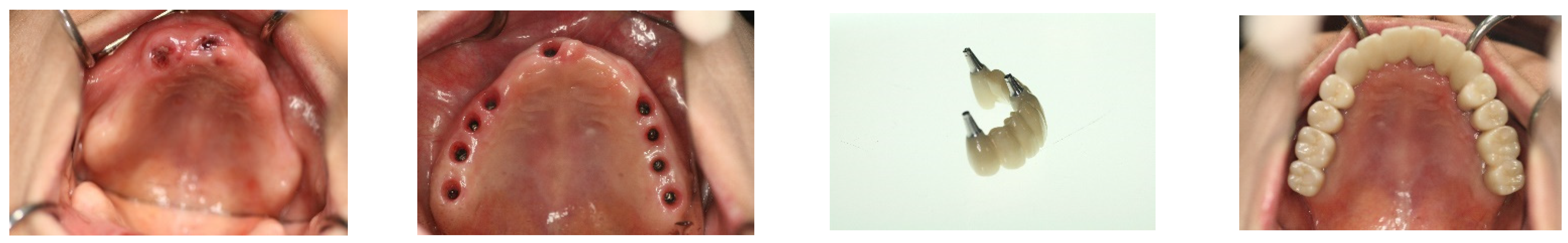 Medicina 60 00759 g006