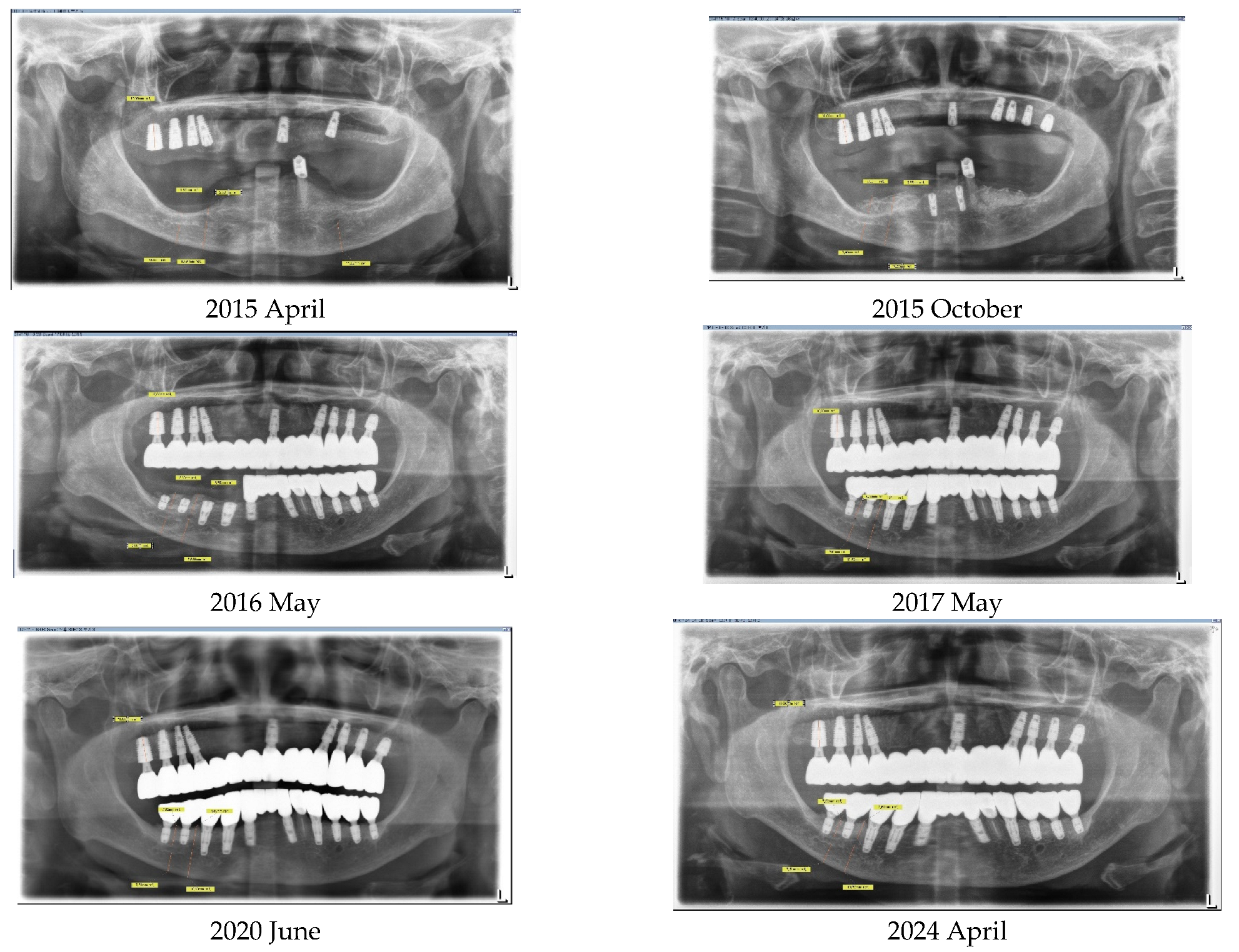 Medicina 60 00759 g011