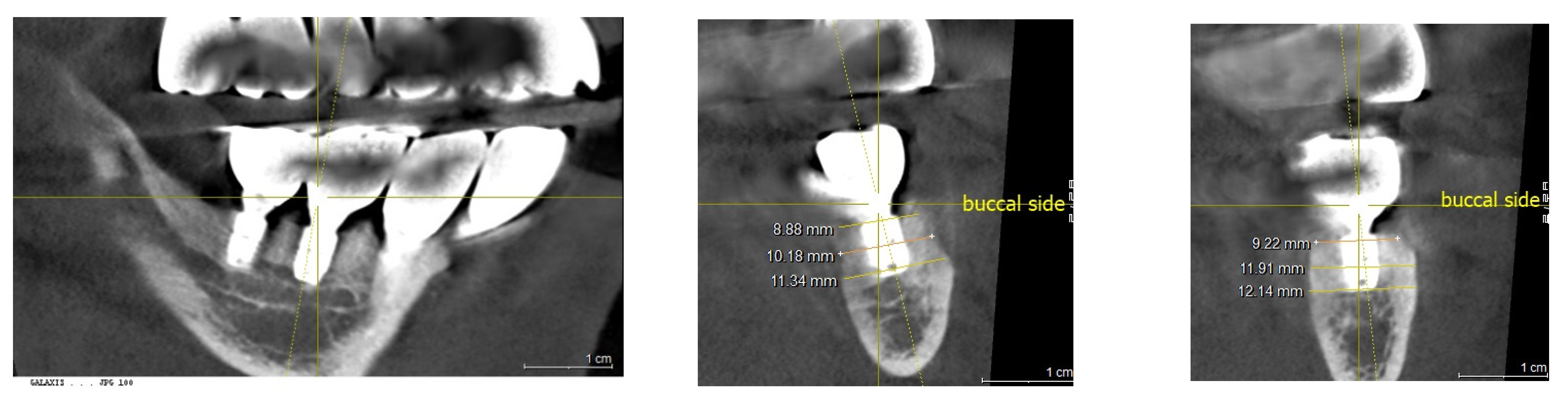 Medicina 60 00759 g012