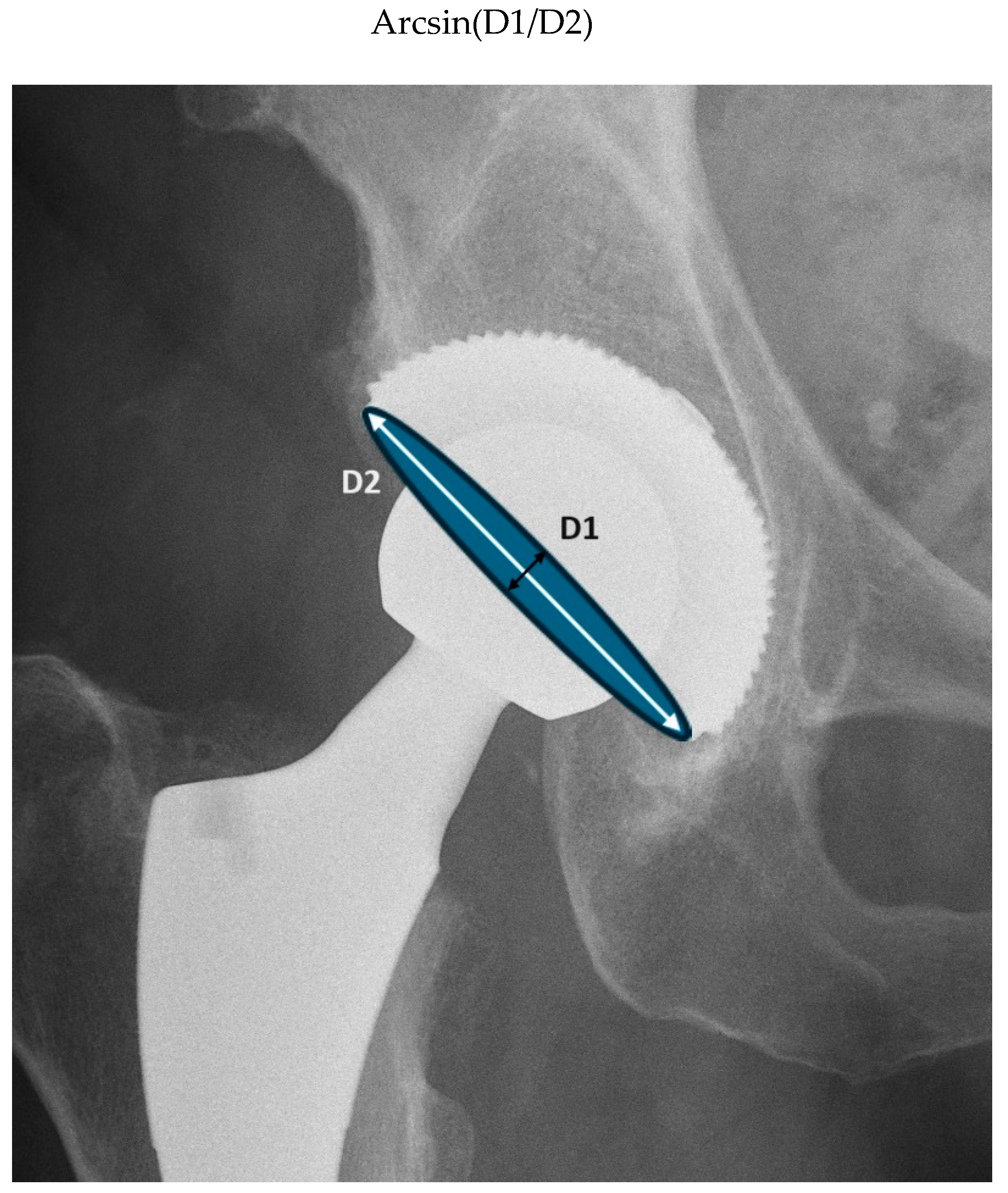 Medicina 60 00772 g005