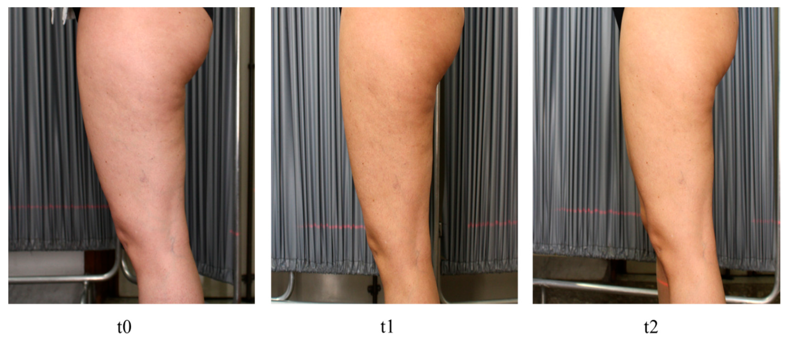 Medicina 60 00781 g002