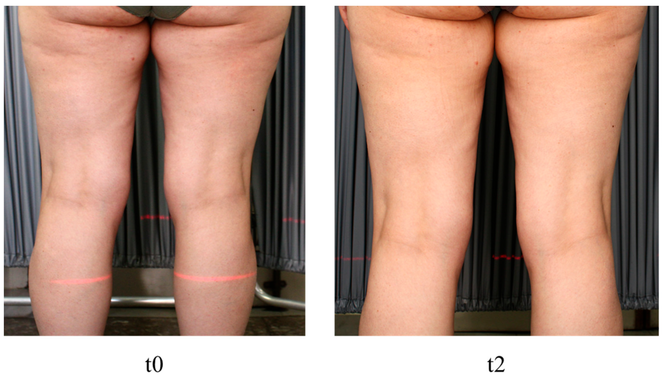 Medicina 60 00781 g003