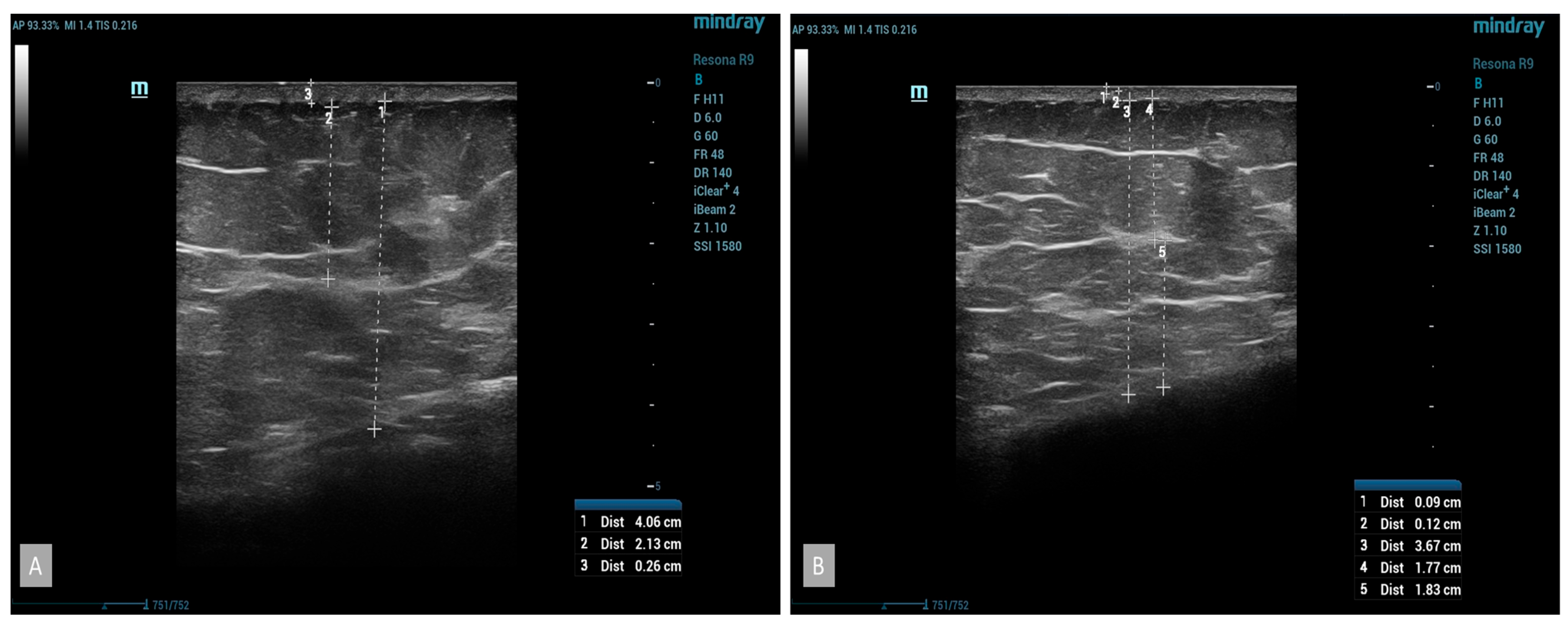 Medicina 60 00781 g004
