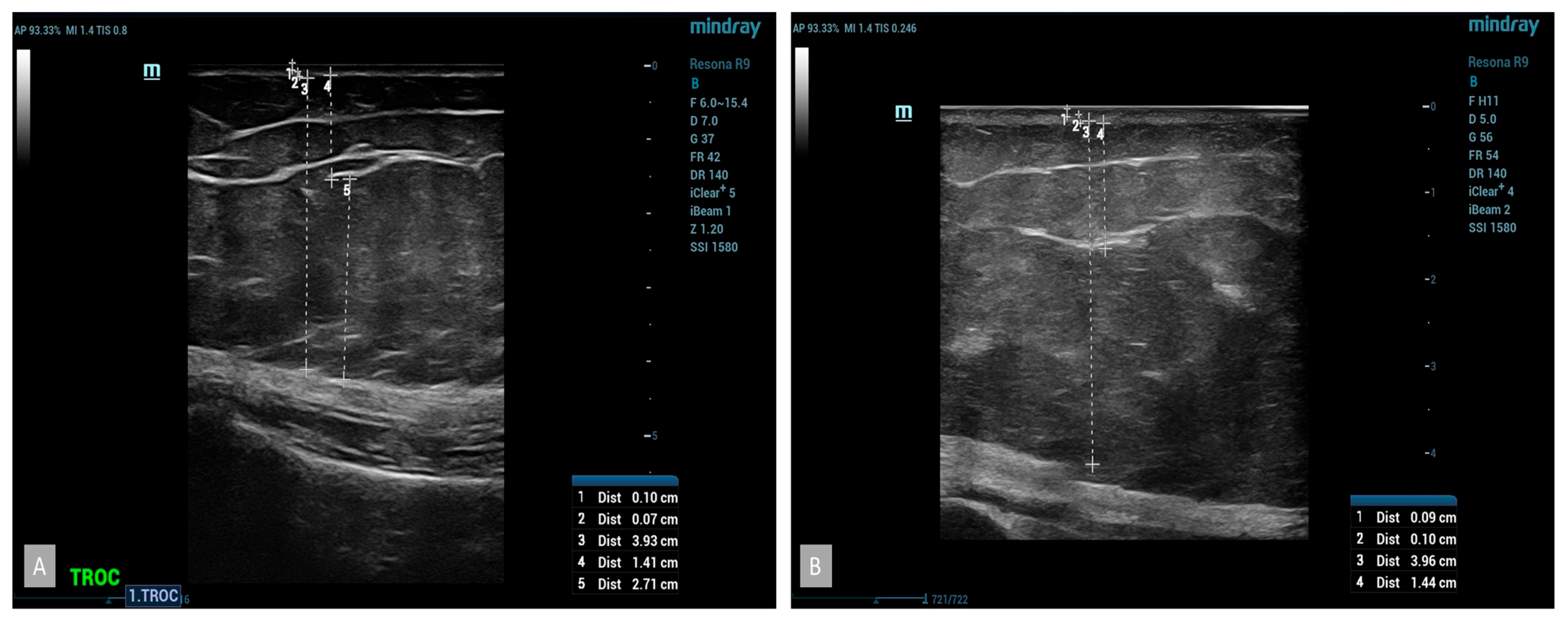 Medicina 60 00781 g005