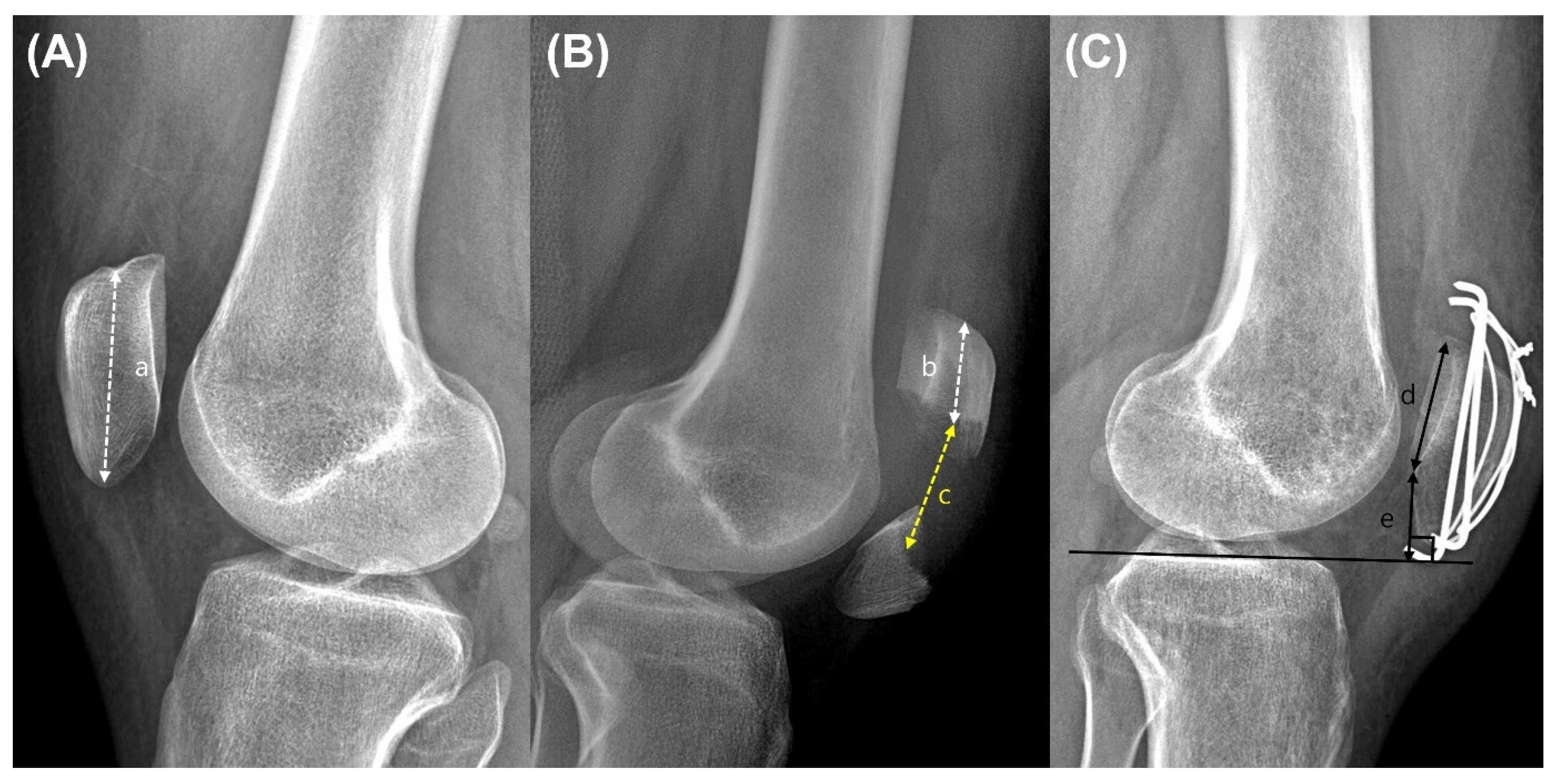 Medicina 60 00789 g001