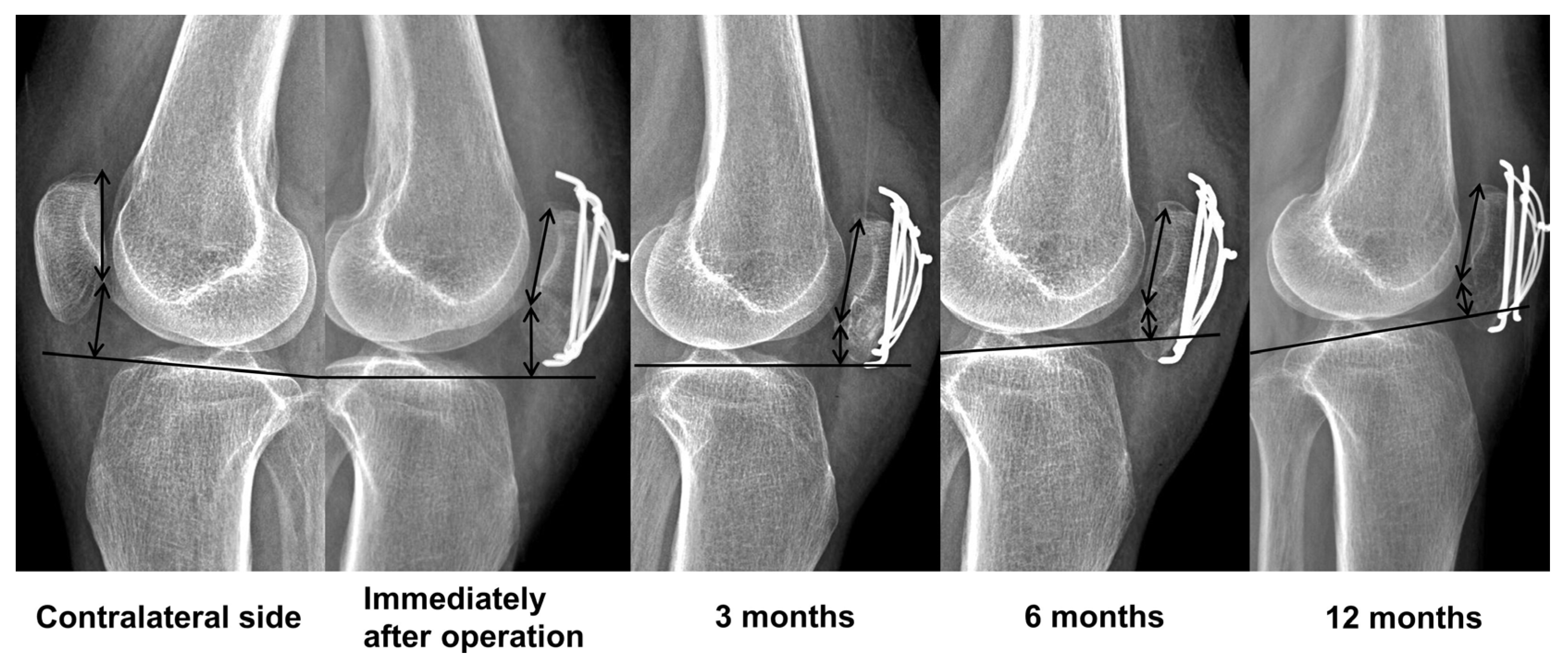 Medicina 60 00789 g003