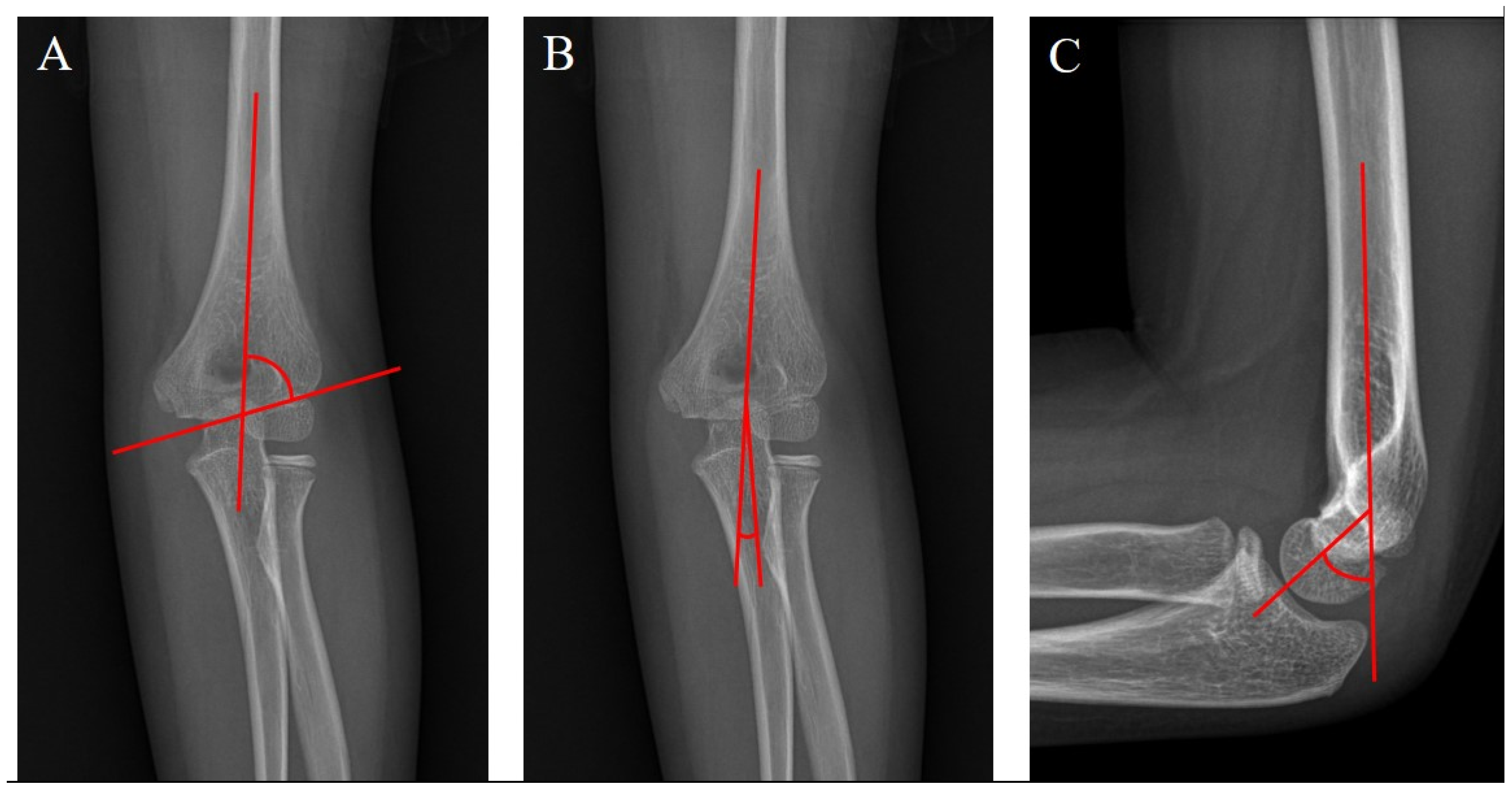 Medicina 60 00791 g001