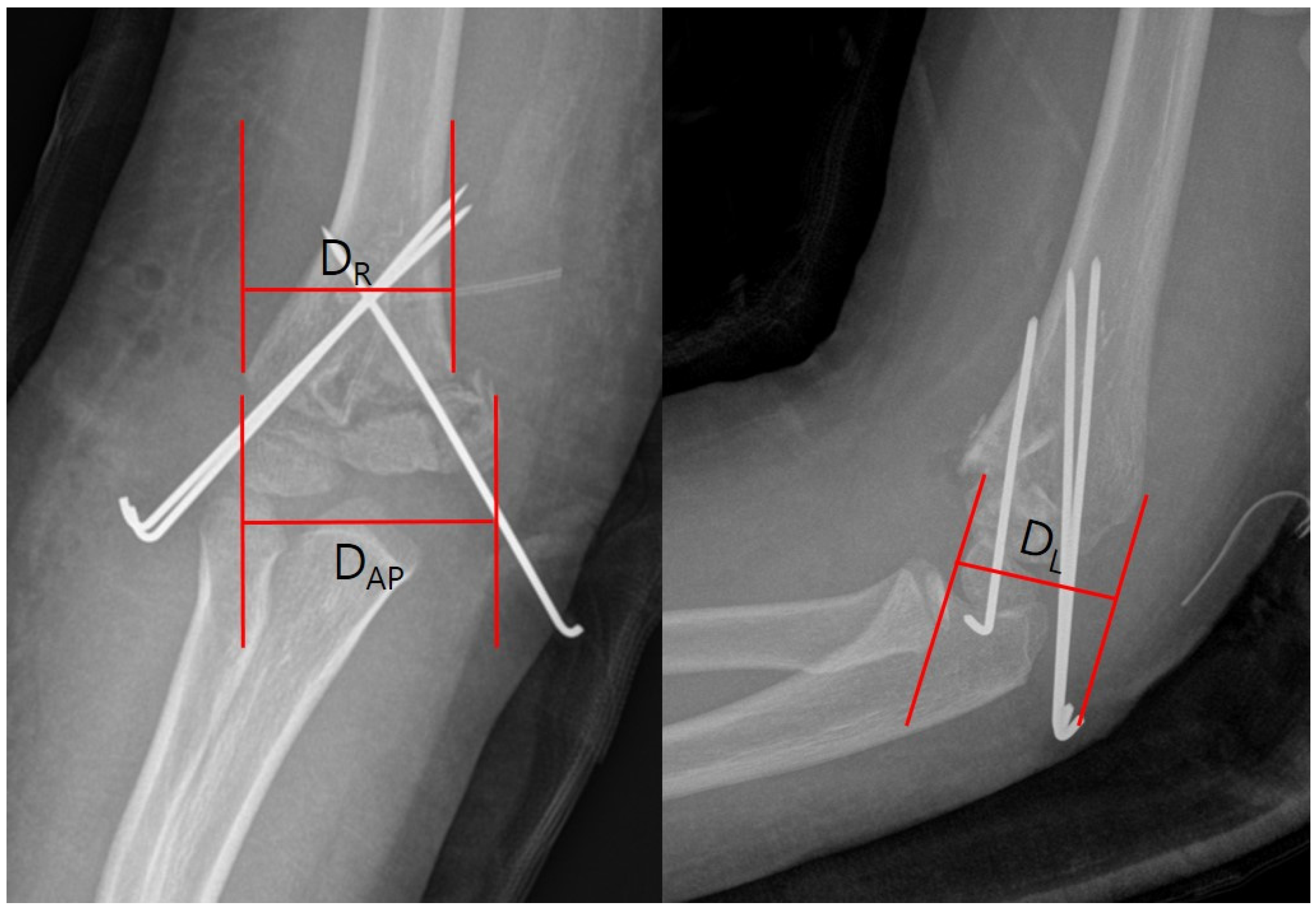 Medicina 60 00791 g002