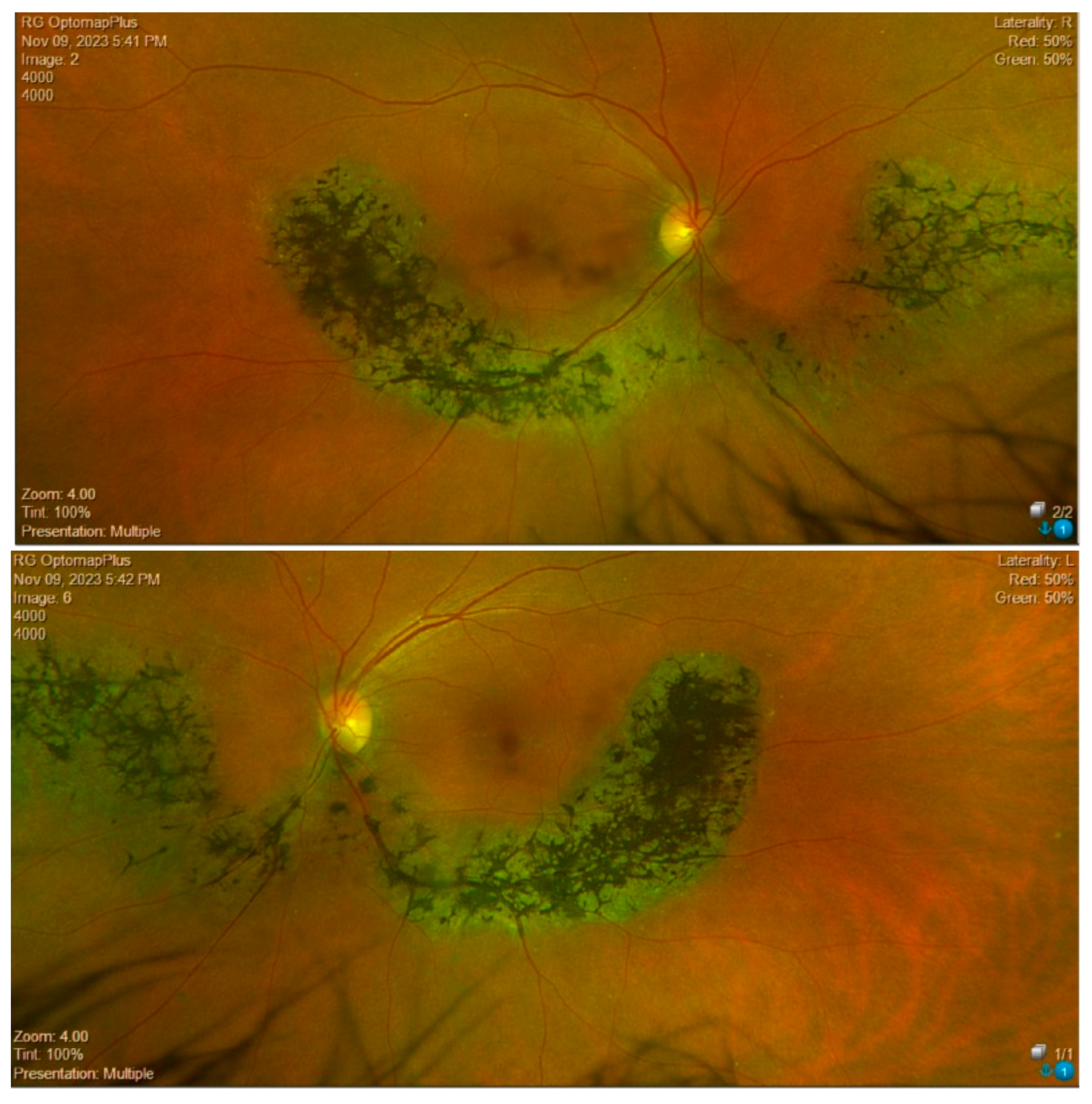 Medicina 60 00797 g001