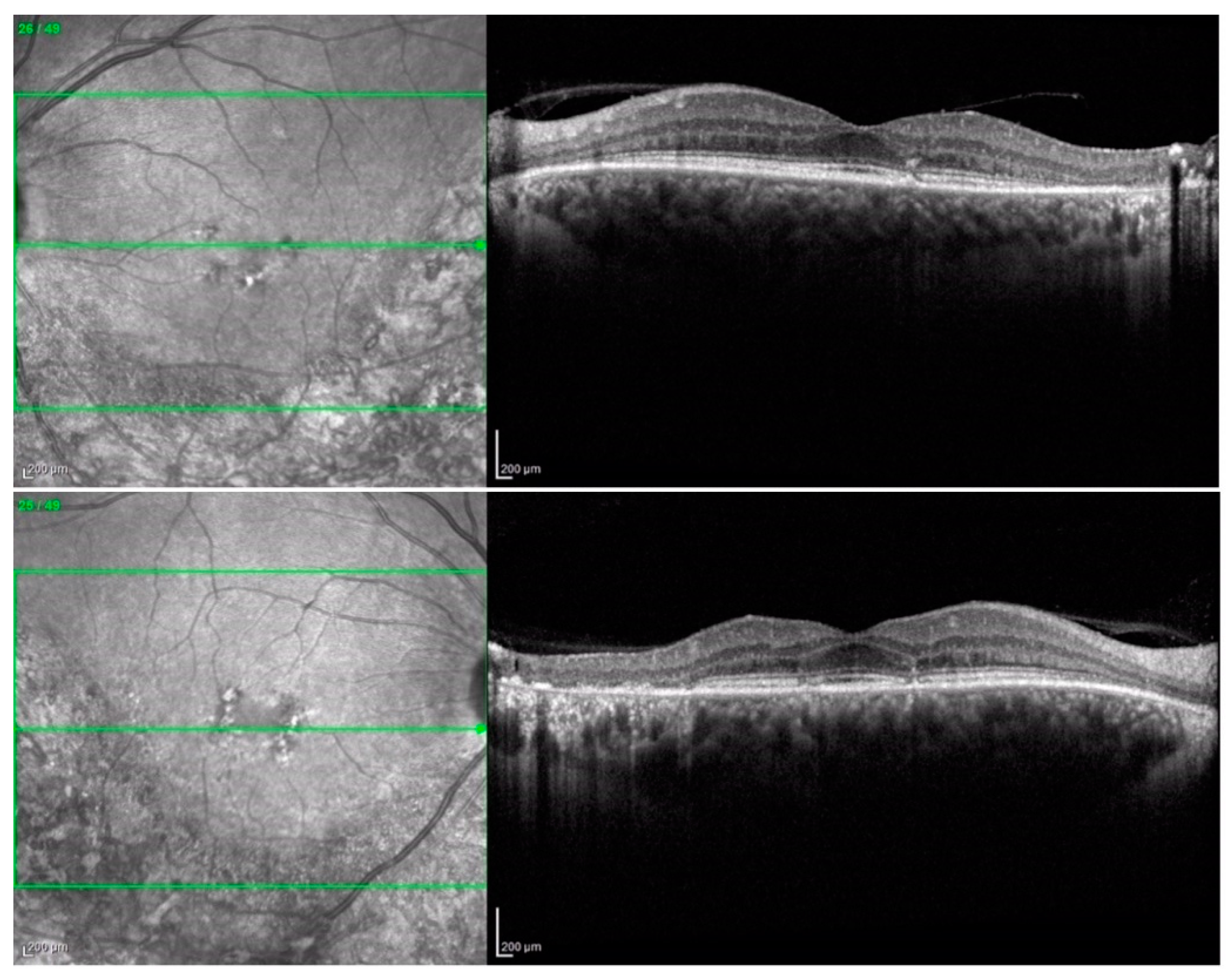 Medicina 60 00797 g002