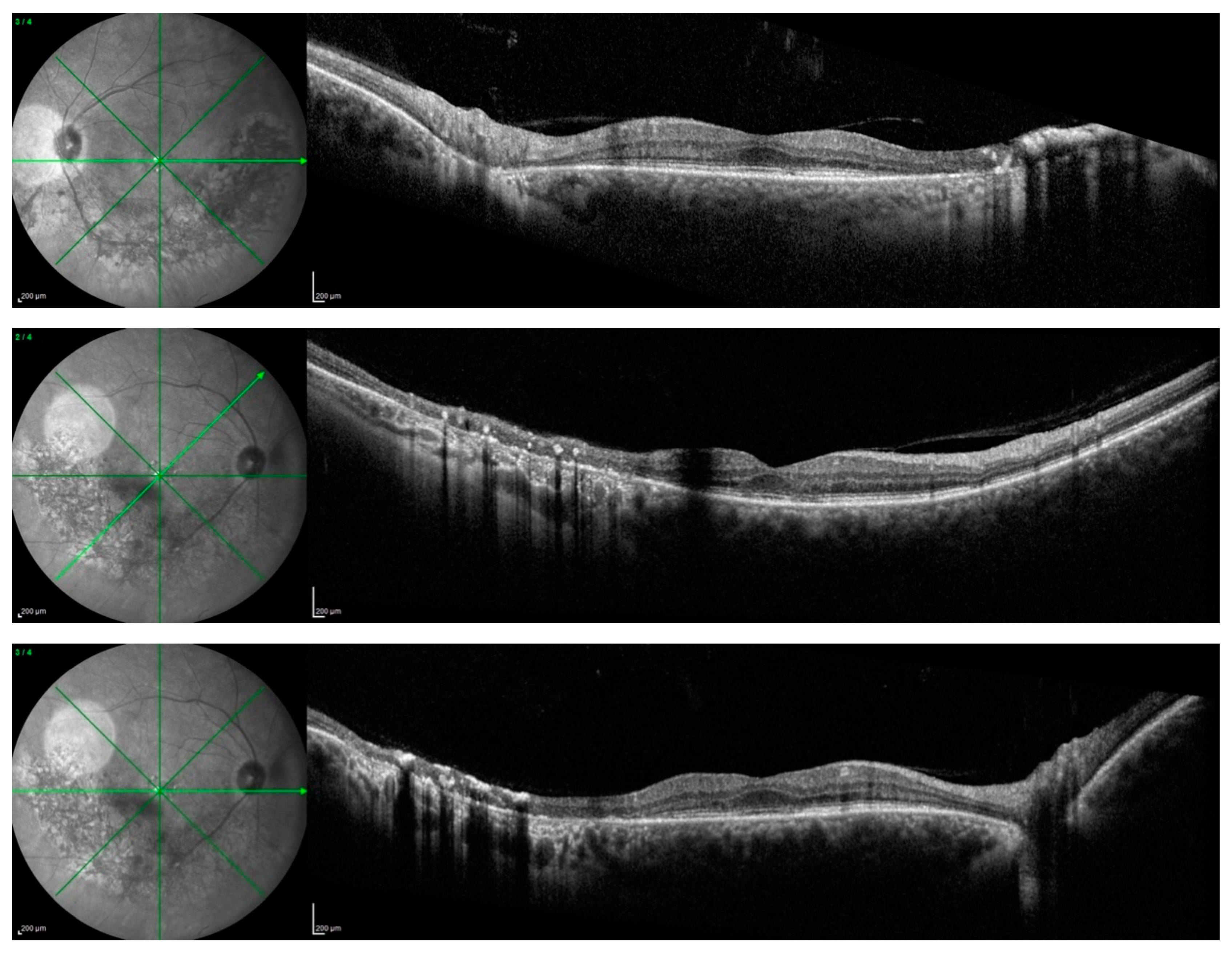 Medicina 60 00797 g003