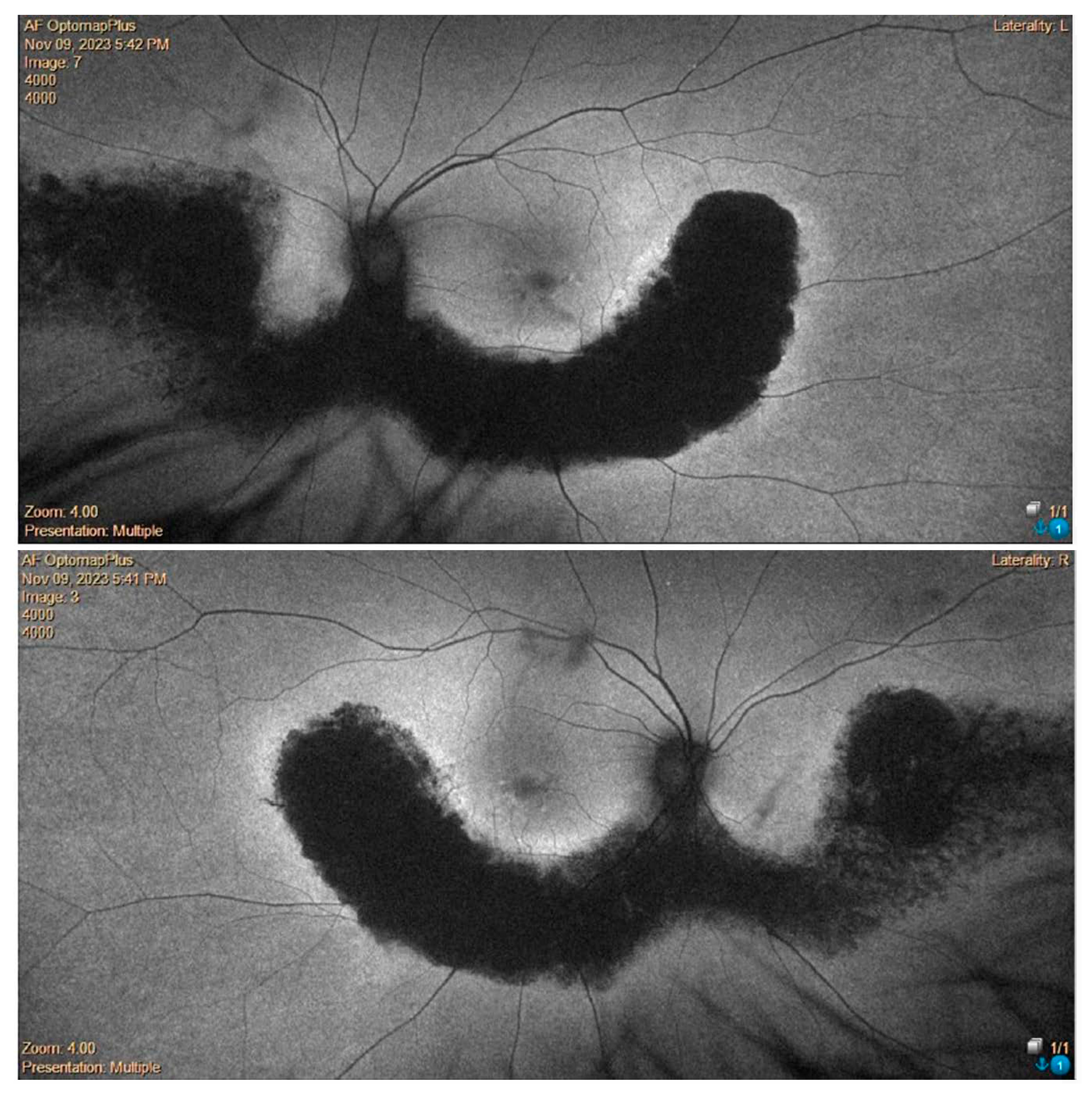 Medicina 60 00797 g004