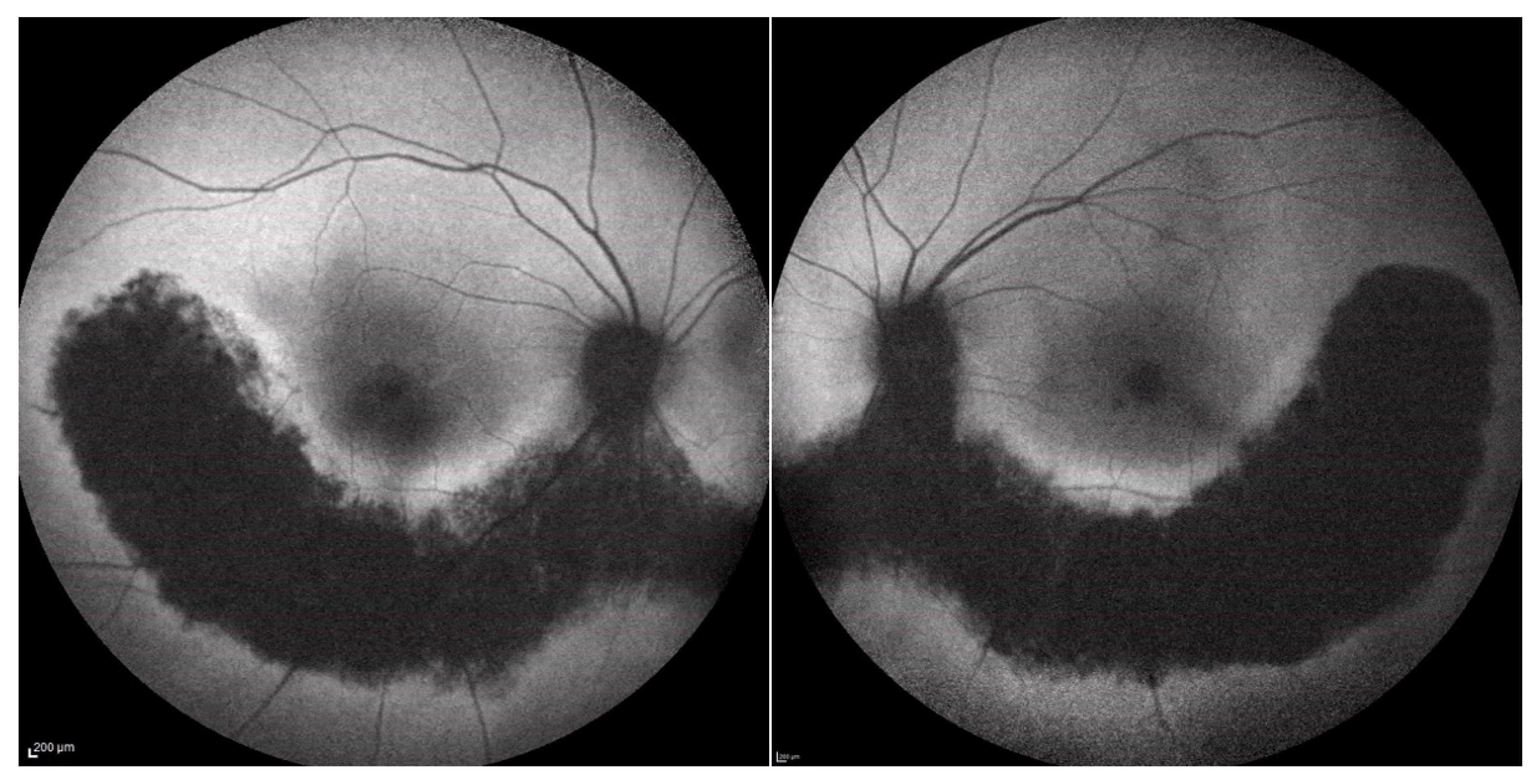 Medicina 60 00797 g005