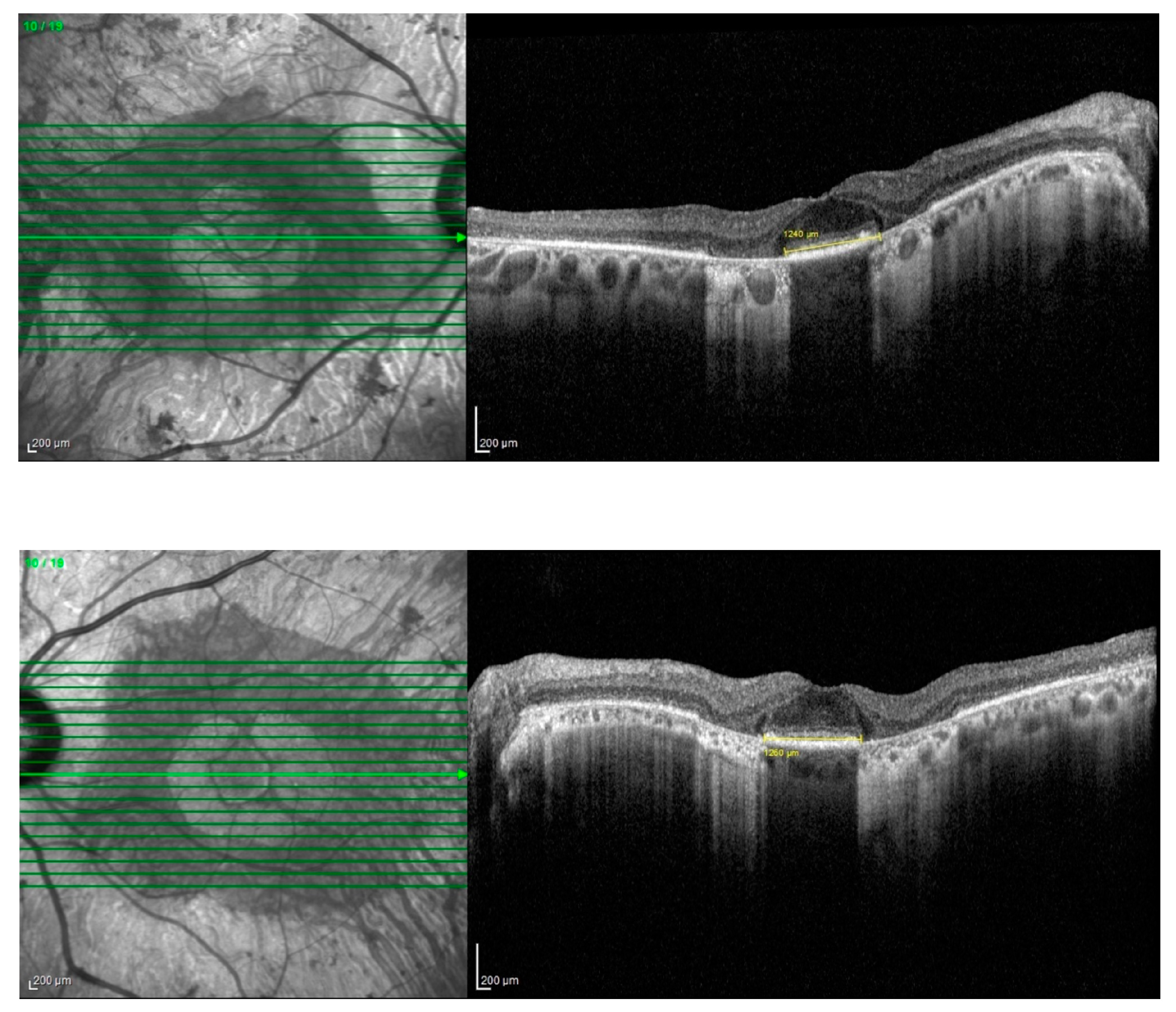 Medicina 60 00797 g006