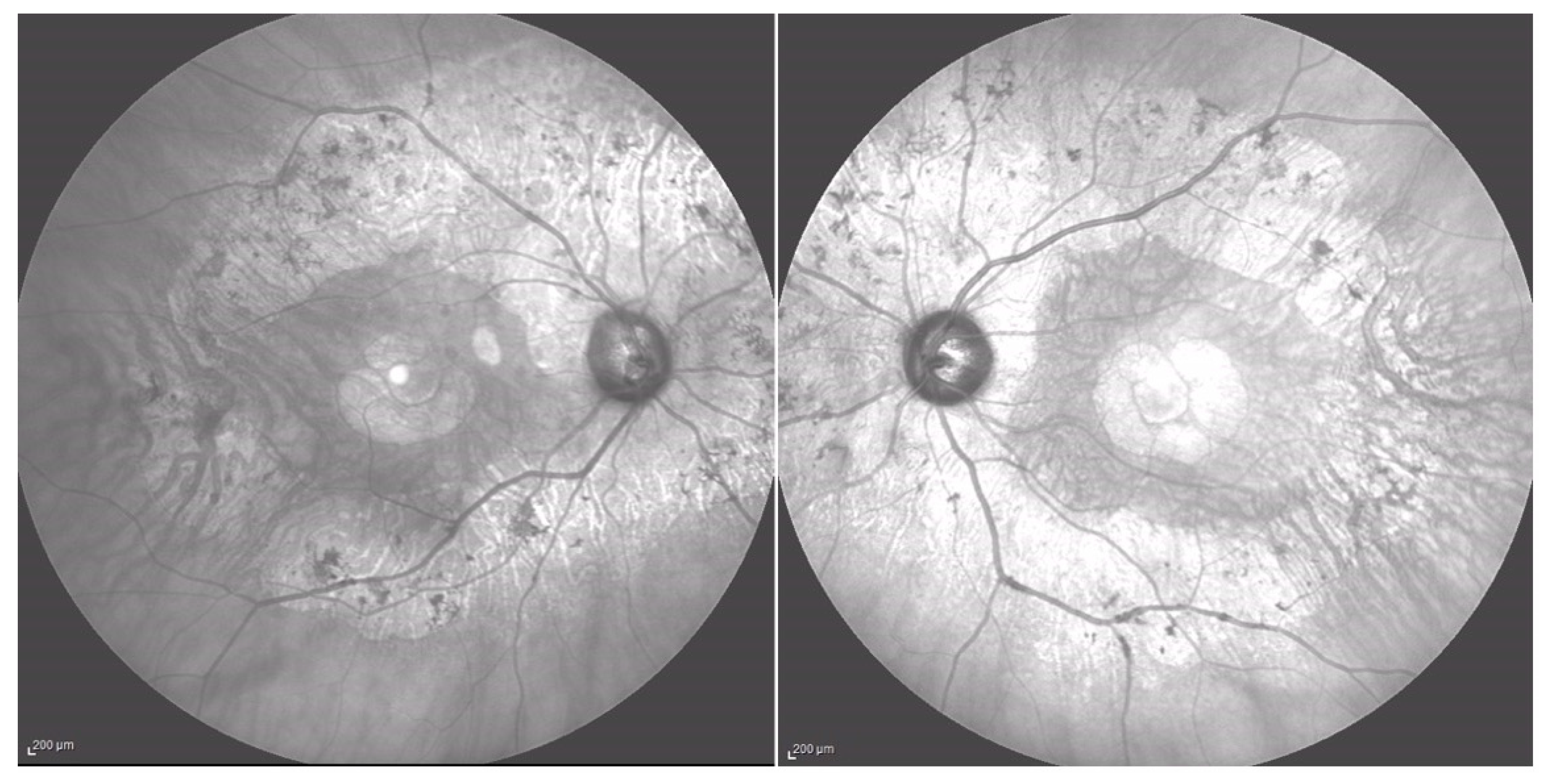 Medicina 60 00797 g008