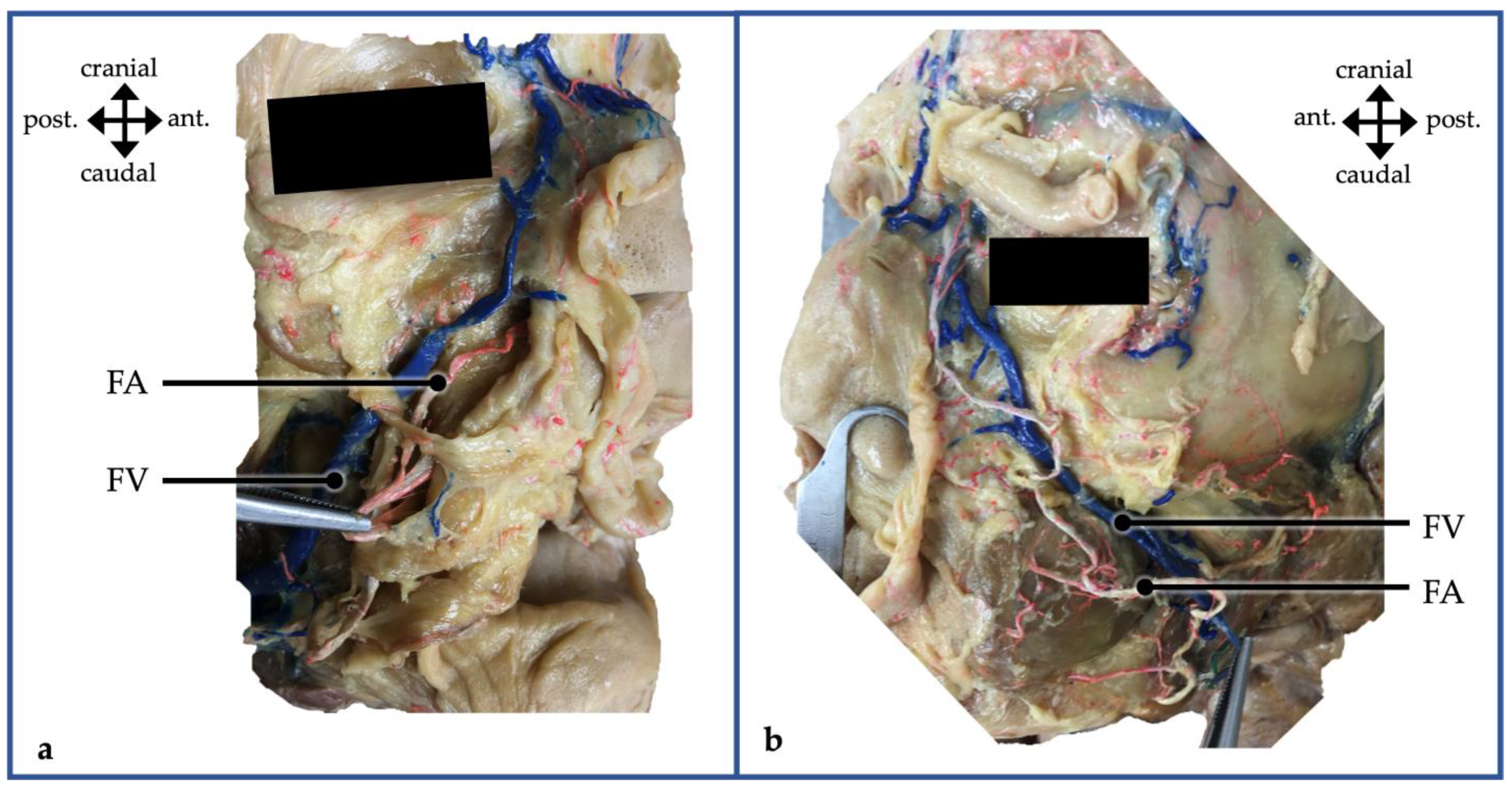 Medicina 60 00805 g001