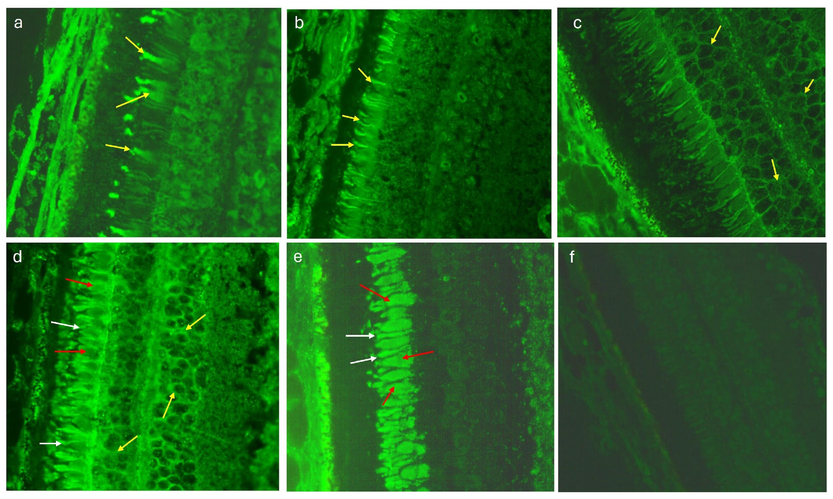 Medicina 60 00810 g002 Medicina 60 00810 g002