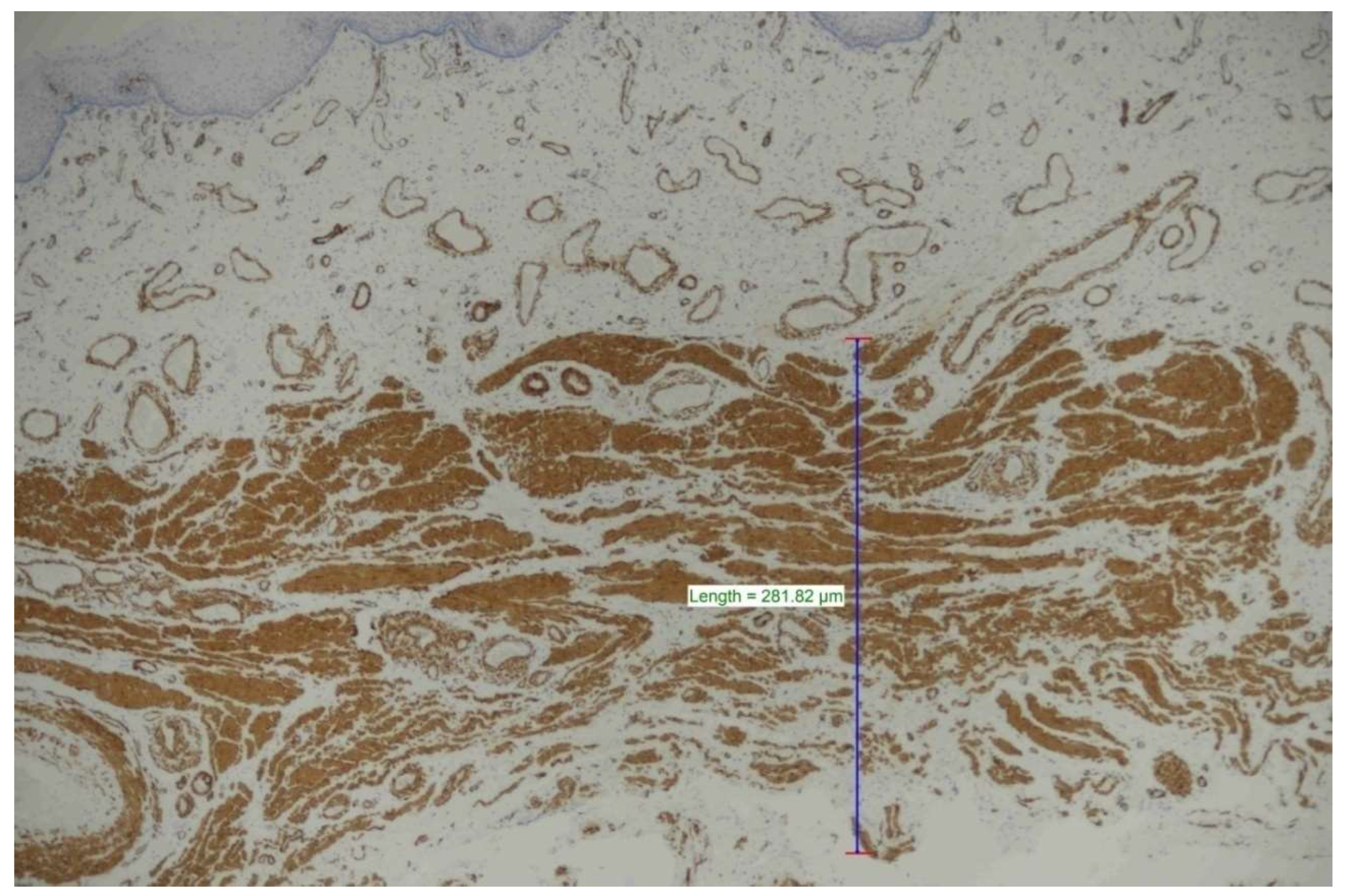 Medicina 60 00816 g001