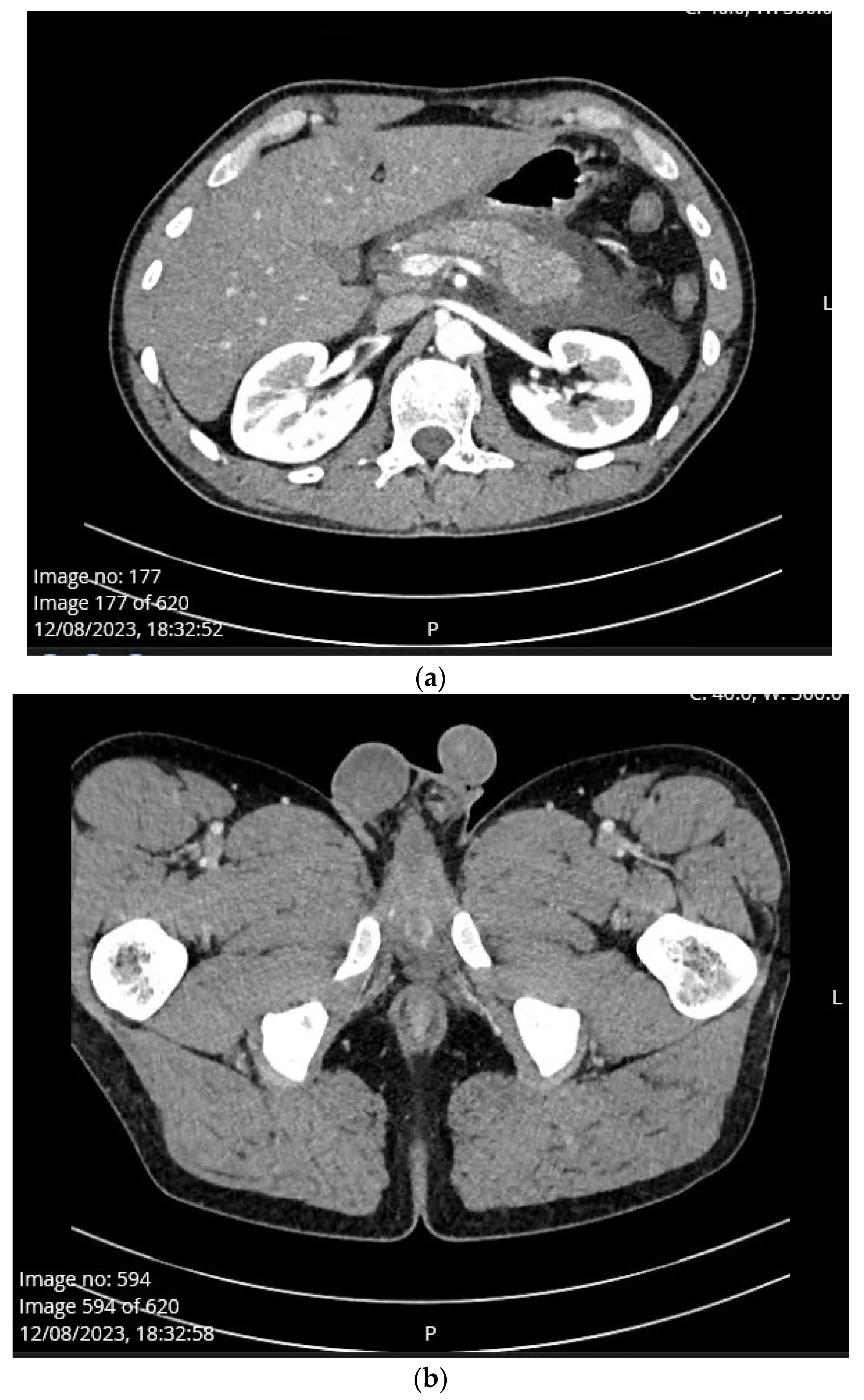 Medicina 60 00820 g001
